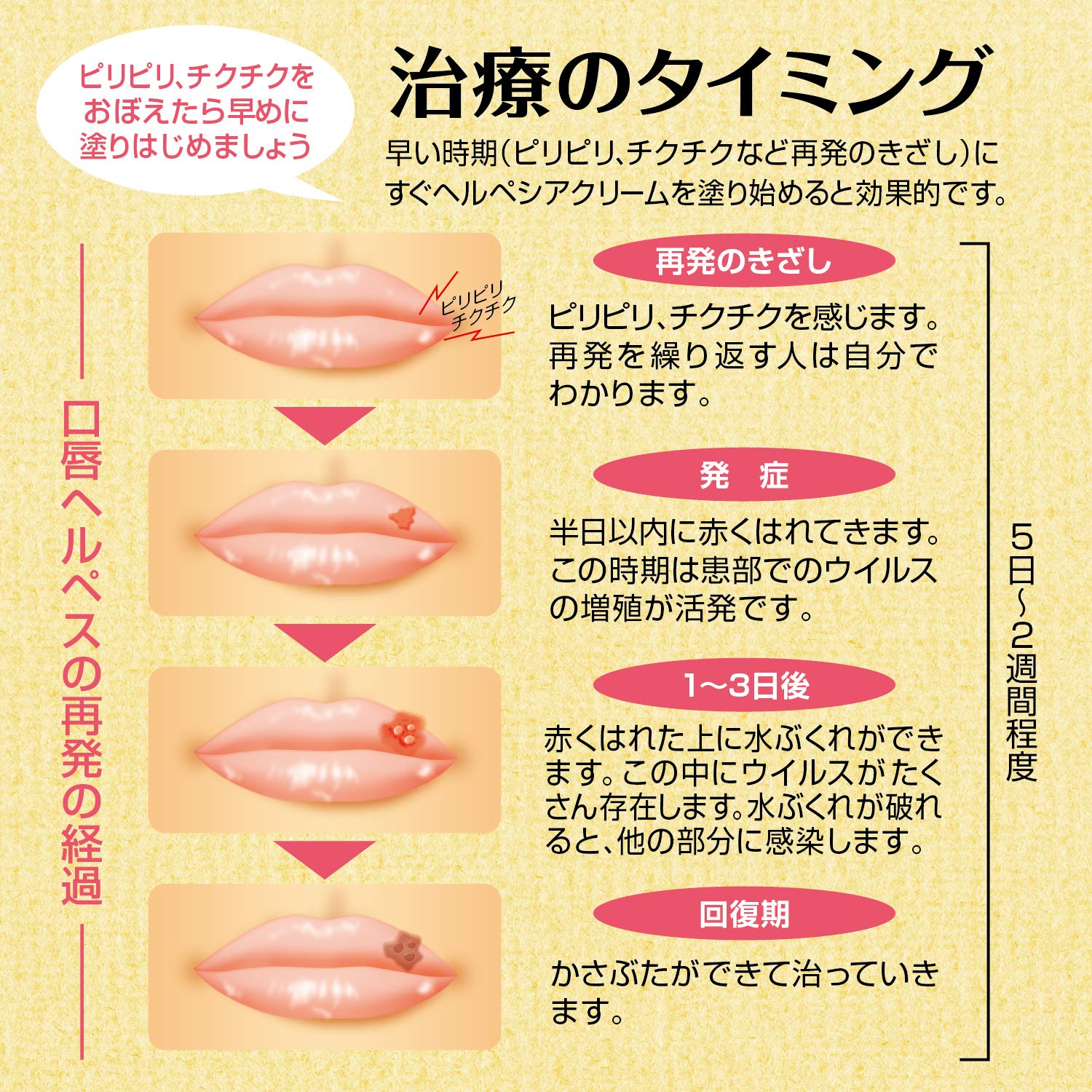 Amazon Co Jp 医薬品ストア 口唇 口内炎治療薬