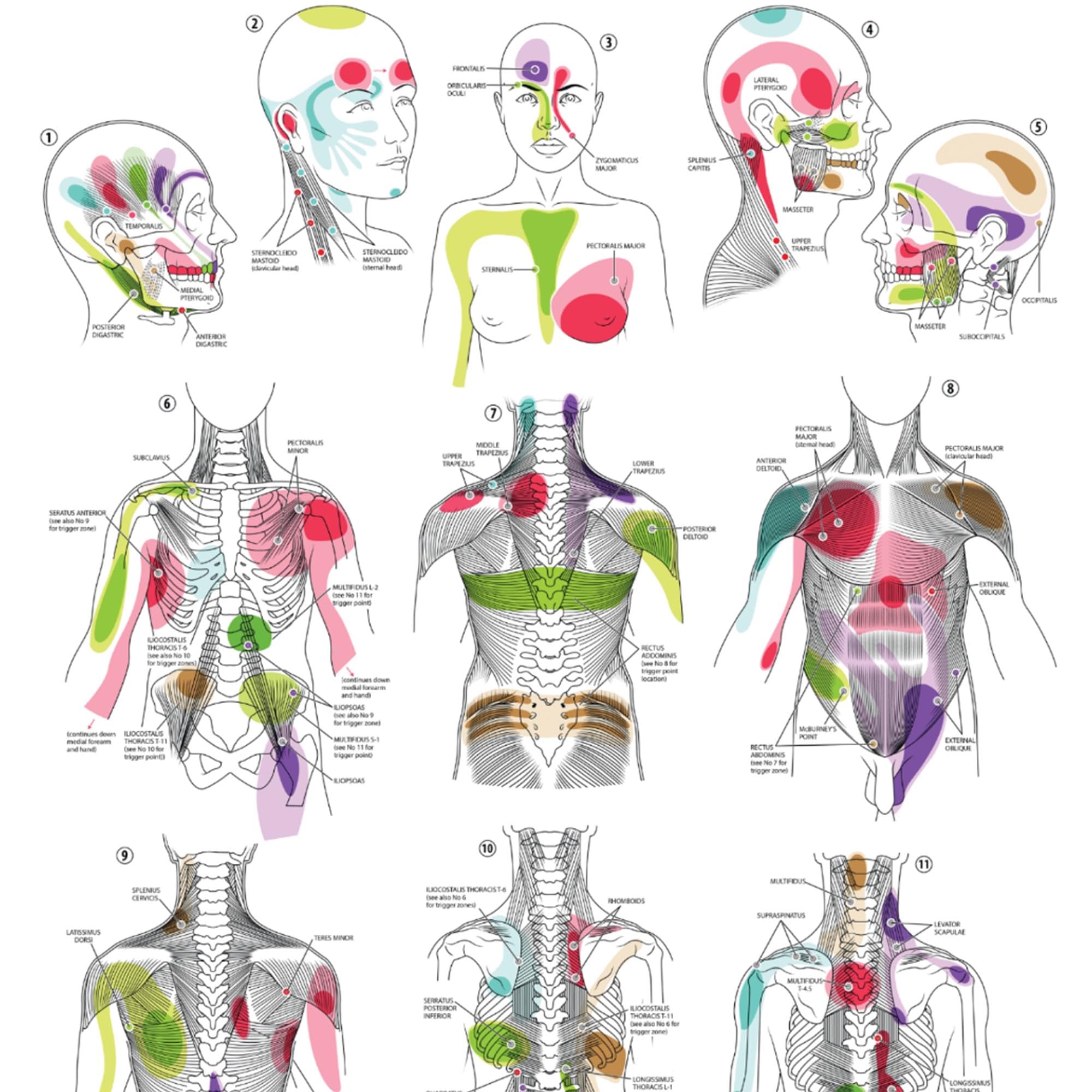 Anatomy Lab Trigger Points I Poster, LAMINATED, Anatomy and Physiology Trigger Points Poster, 17.3 x 22.5 Inches, Trigger Points Anatomy Poster