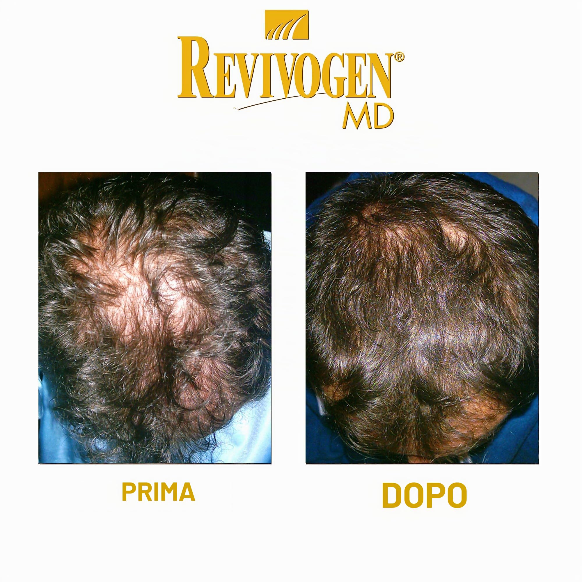 Revivogen MD Shampoo con Scalp Therapy 1 mese