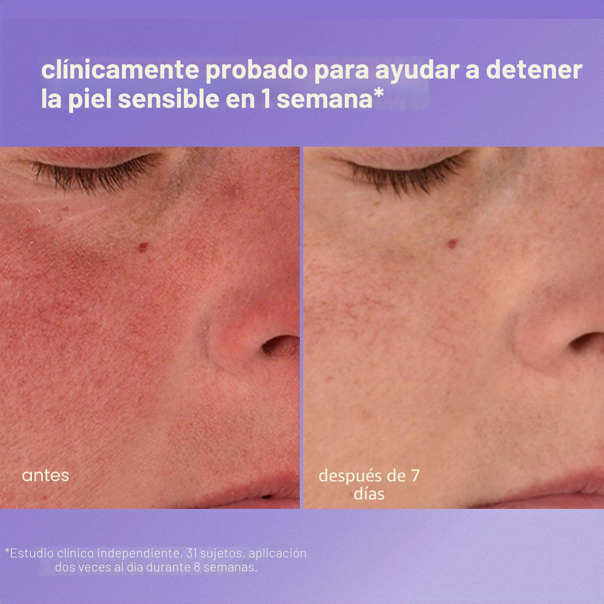 Dermalogica Stabilizing Repair Cream para Piel Sensible 50ml | Crema facial con cica que calma las pieles sensibles y ayuda a reforzar la barrera cutánea.