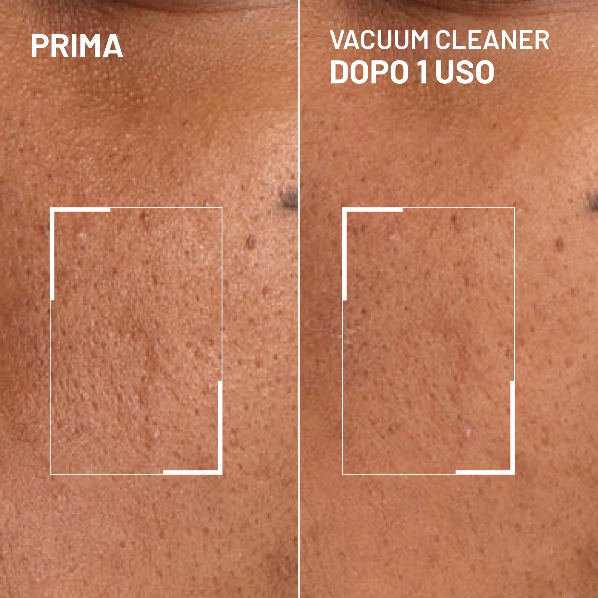 Dr. Brandt Pores No More Vacuum Cleaner - Maschera purificante pori per liberare e restringere i pori - 30 g