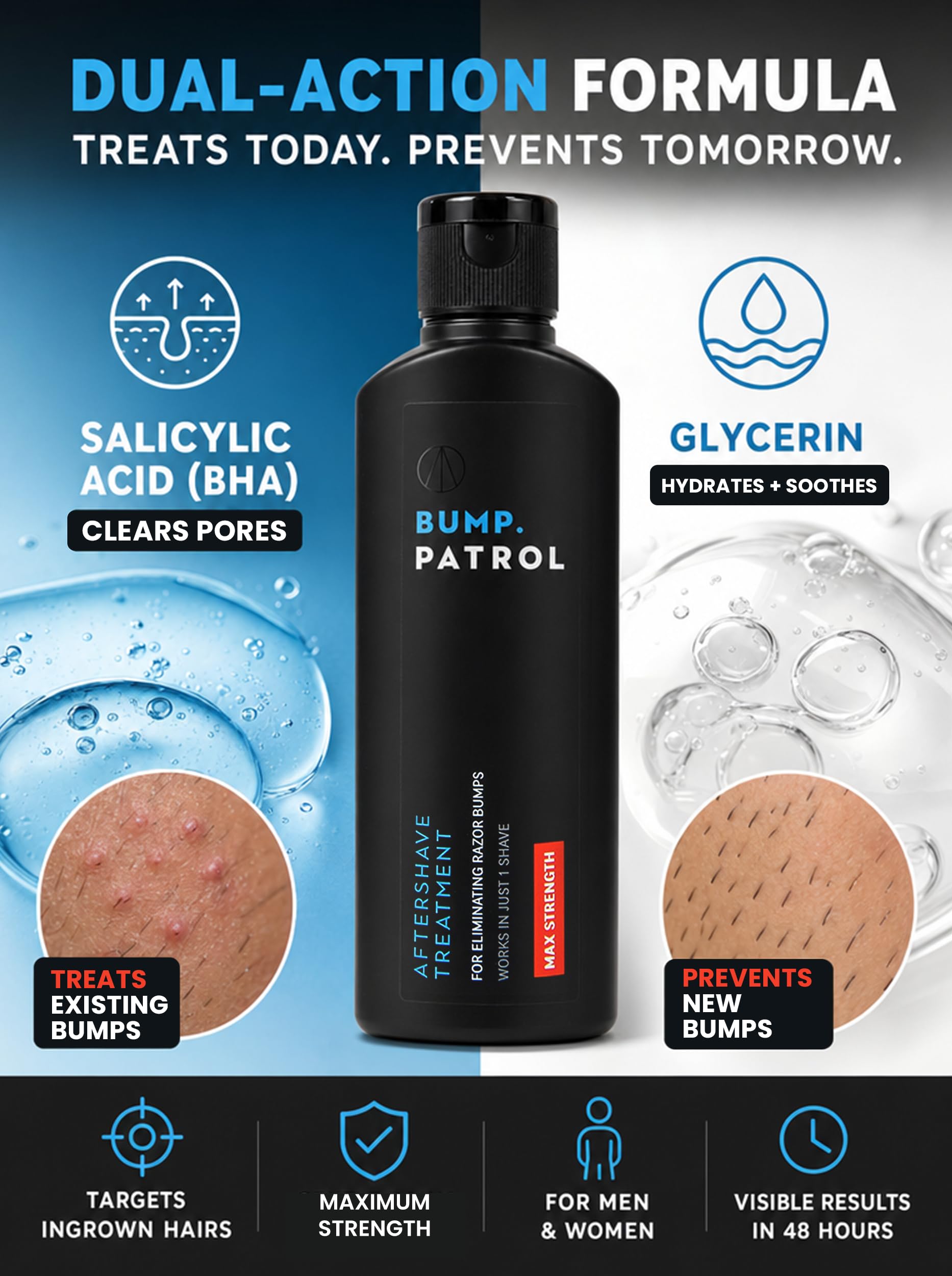 Bump Patrol Maximum Strength Dermatologist Approved Moisturizing Aftershave (2 oz) by Bump Patrol