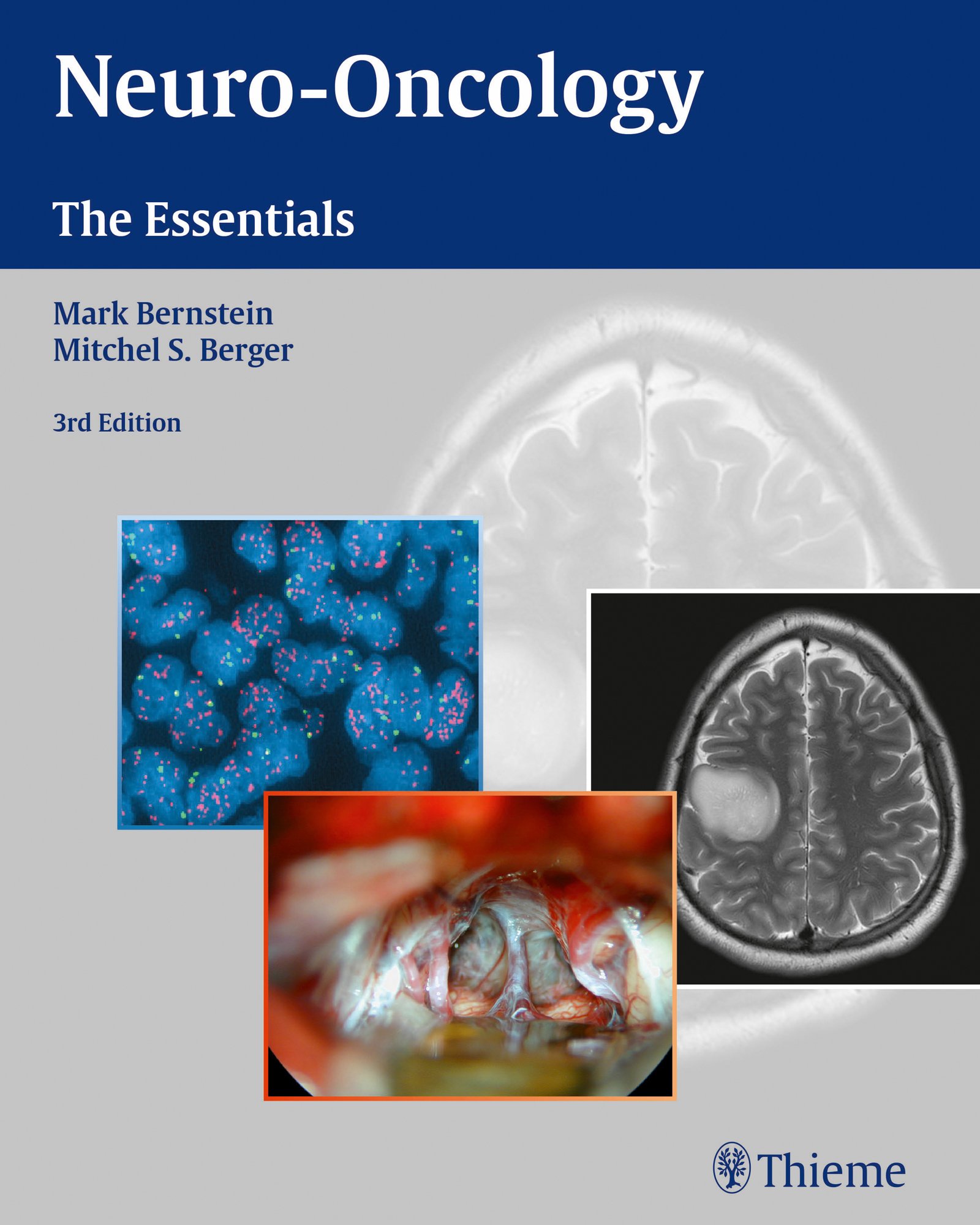 Neuro-Oncology: The Essentials