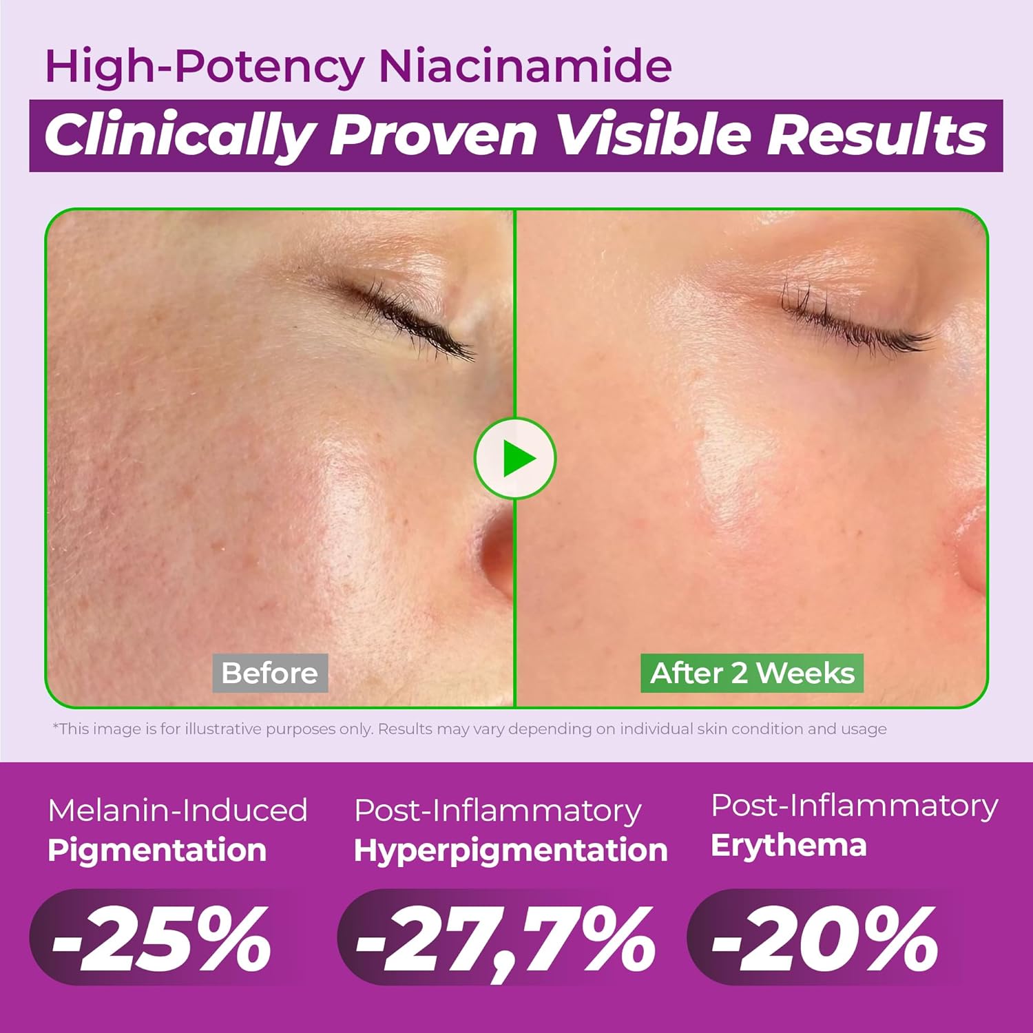 JUMISO Niacinamide 20% Face Serum, Dark Spot & Uneven Tone Care, TXA + Glutathione, Pore & Oil Control for Glass Skin, Centella Soothing, Korean Skincare, 40ml (1.35 fl oz) - Image 3