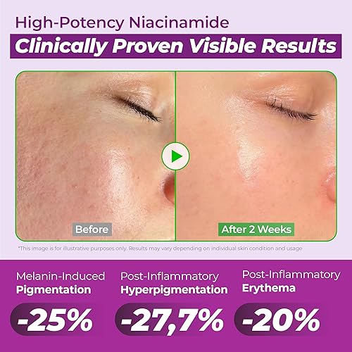 Miniatura 3 de JUMISO Suero facial de niacinamida al 20%, cuidado de manchas oscuras y tonos desiguales, TXA + glutatión, control de poros y aceite para piel de