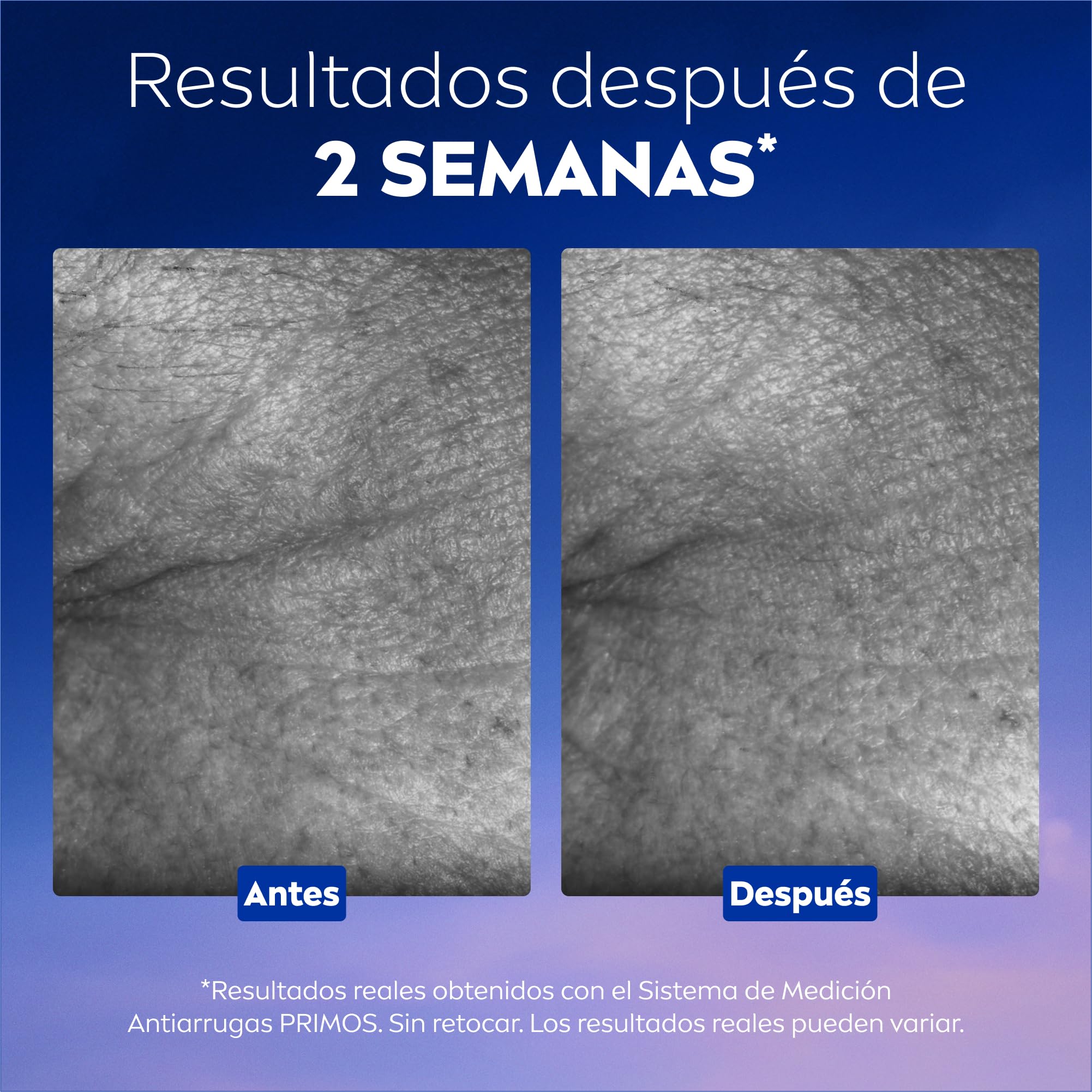 NIVEA Cellular Epigenetics - Serum Facial Rejuvenecedor con Epicelline - Cuidado facial Antiedad - 3 Tipos de Ácido Hialurónico - Revierte la Edad de la Piel - Todo tipo de pieles - 30 ml
