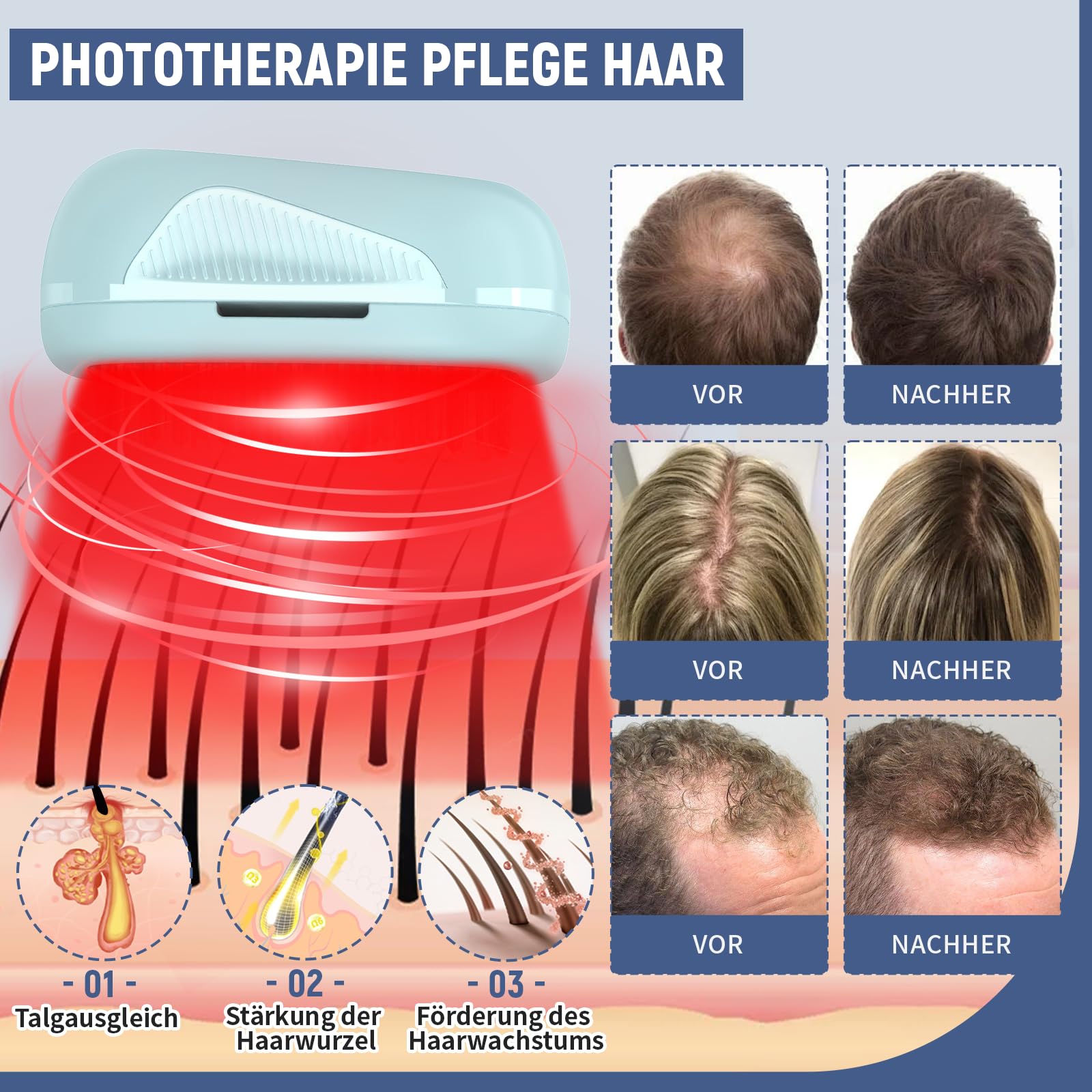 Laser Comb for Hair Growth, Pettine laser per la crescita dei capelli (autorizzato dalla FDA), dispositivo laser per la crescita dei capelli di grado medico