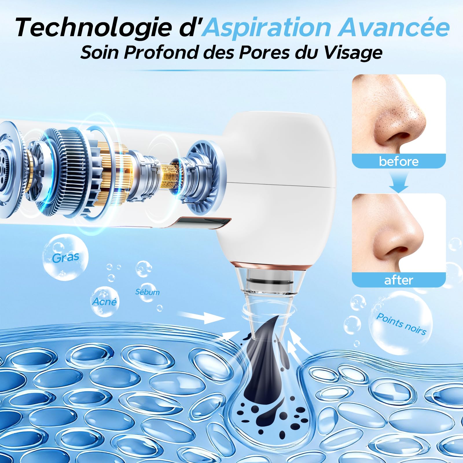 Aspirateur Point Noir 3 Modes Visage 5 Sondes, Blanc | Extracteur de Point Noir, Nettoyage du Visage, Inclut Ensemble Traditionnel d'Aiguilles,tire comedon