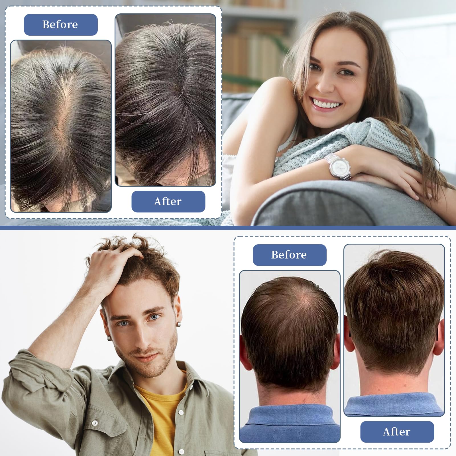 Peine láser para el crecimiento del cabello, terapia de luz roja para el crecimiento del cabello, tratamiento de pérdida de cabello con láser para hombres y mujeres, tratamiento de adelgazamiento del