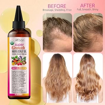 35-in-1 Blend Rosemary Hair Oil with Batana, Argan, Jojoba, Castor Oil, Infused with Keratin, Biotin & Vitamin A C D E, Super Hair & Scalp Oil for Strengthening & Nourishing Hair, All Hair Types