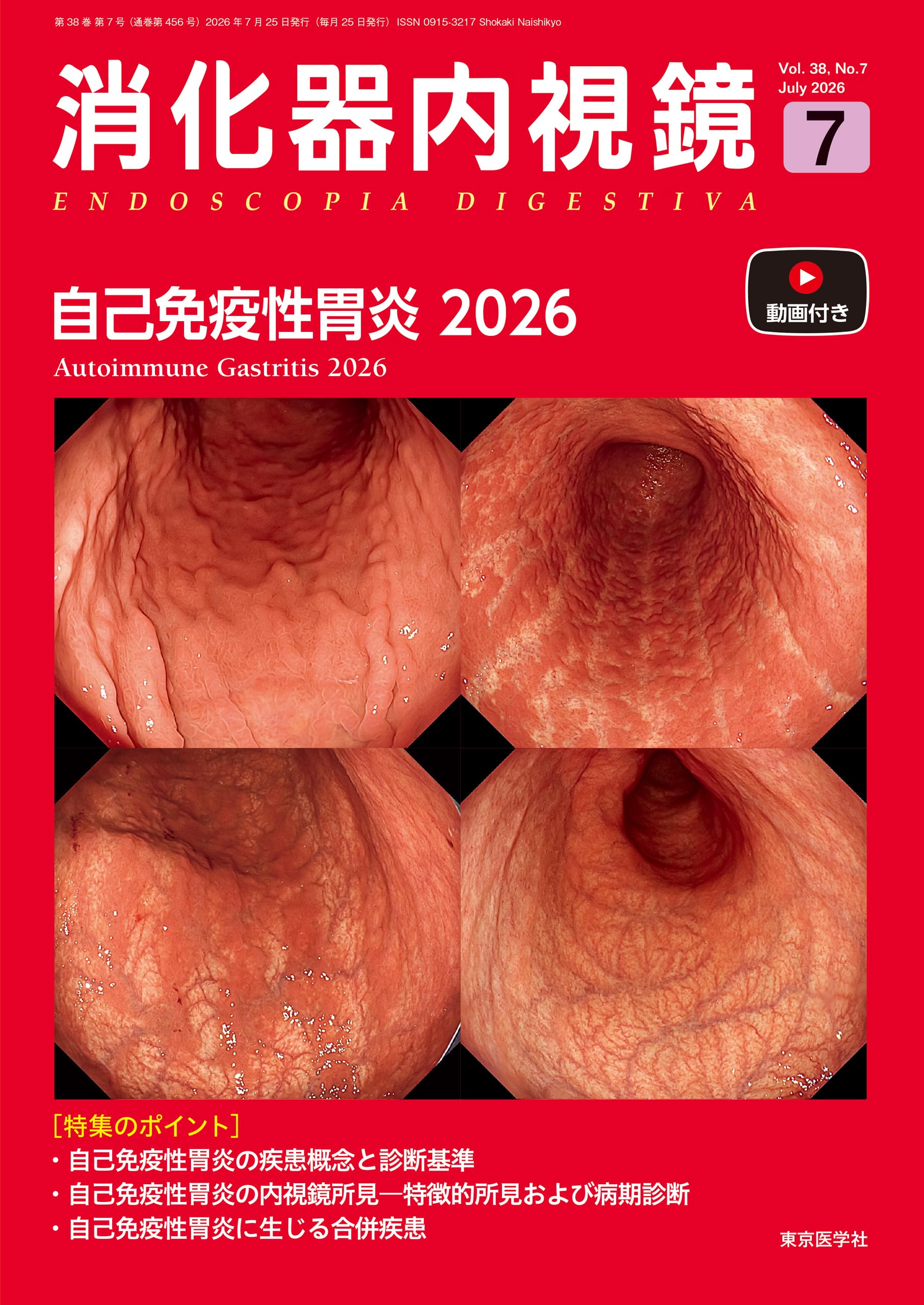 消化器内視鏡38巻7号 2026年7月号 自己免疫性胃炎2026 | 「消化器内視
