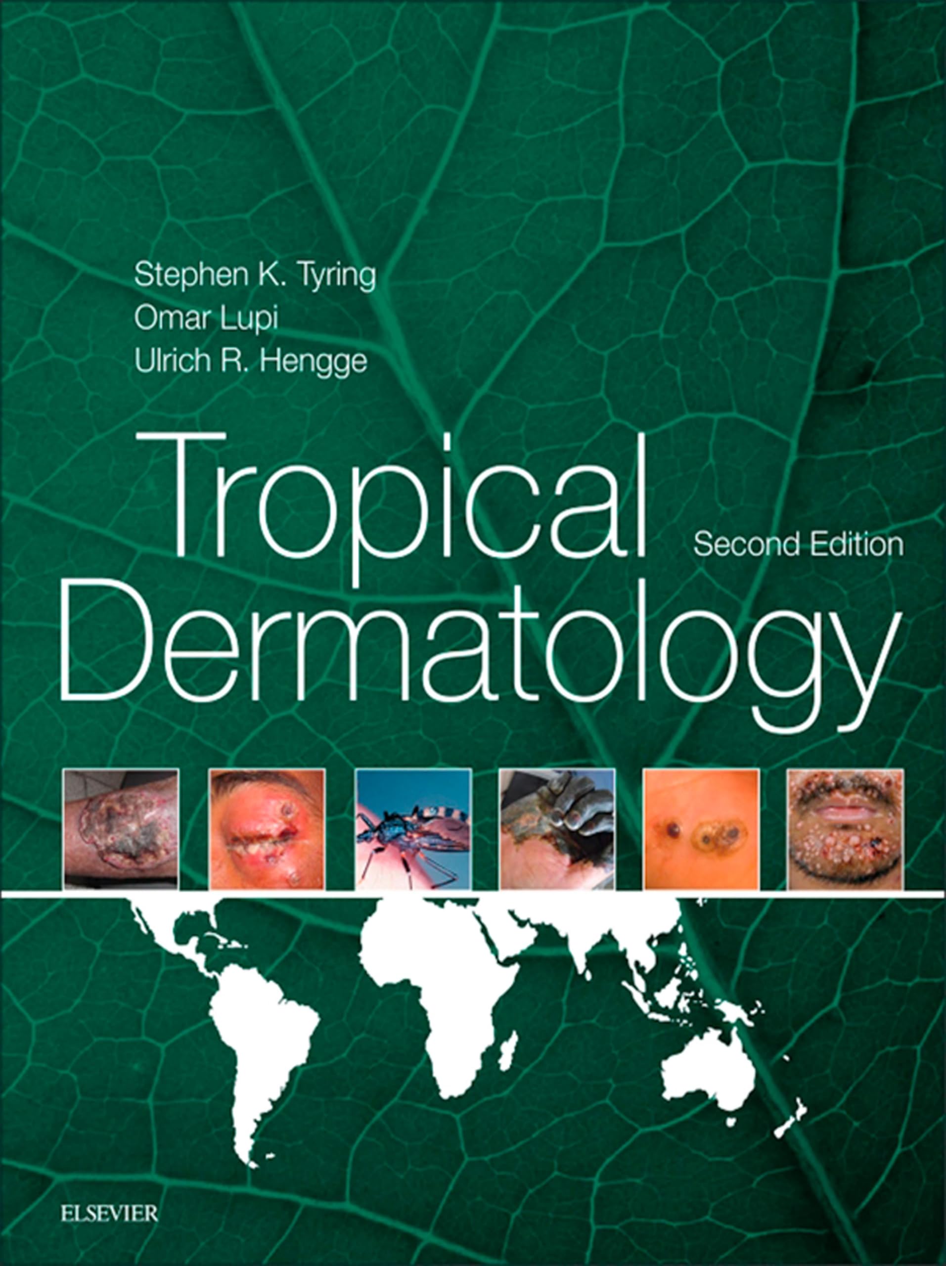 Tropical Dermatology E-Book (English Edition)