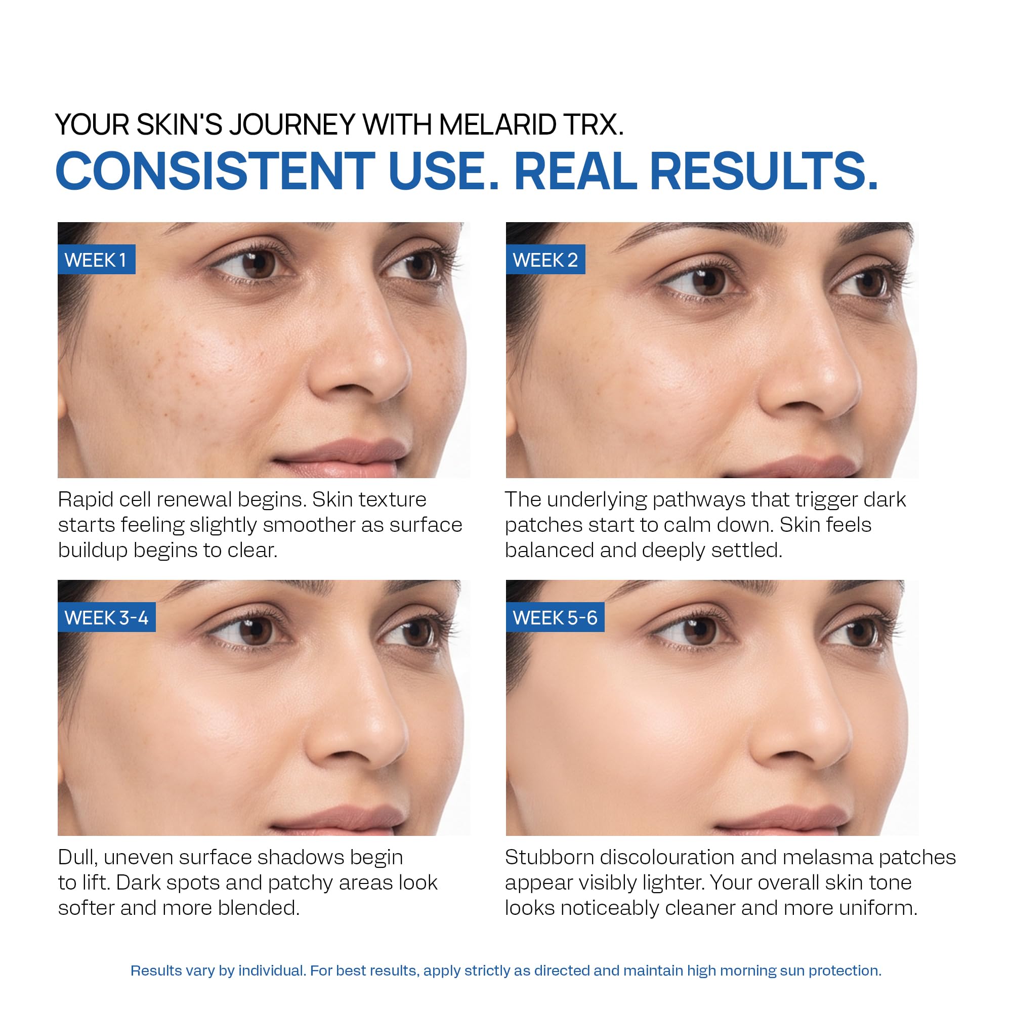 Yuderma Melarid Dark Spot Correcting Serum – TRX Serum pH 3.5 – For Melano Correction & Pigmentation – For Uneven Skin Tone, 40ml 4