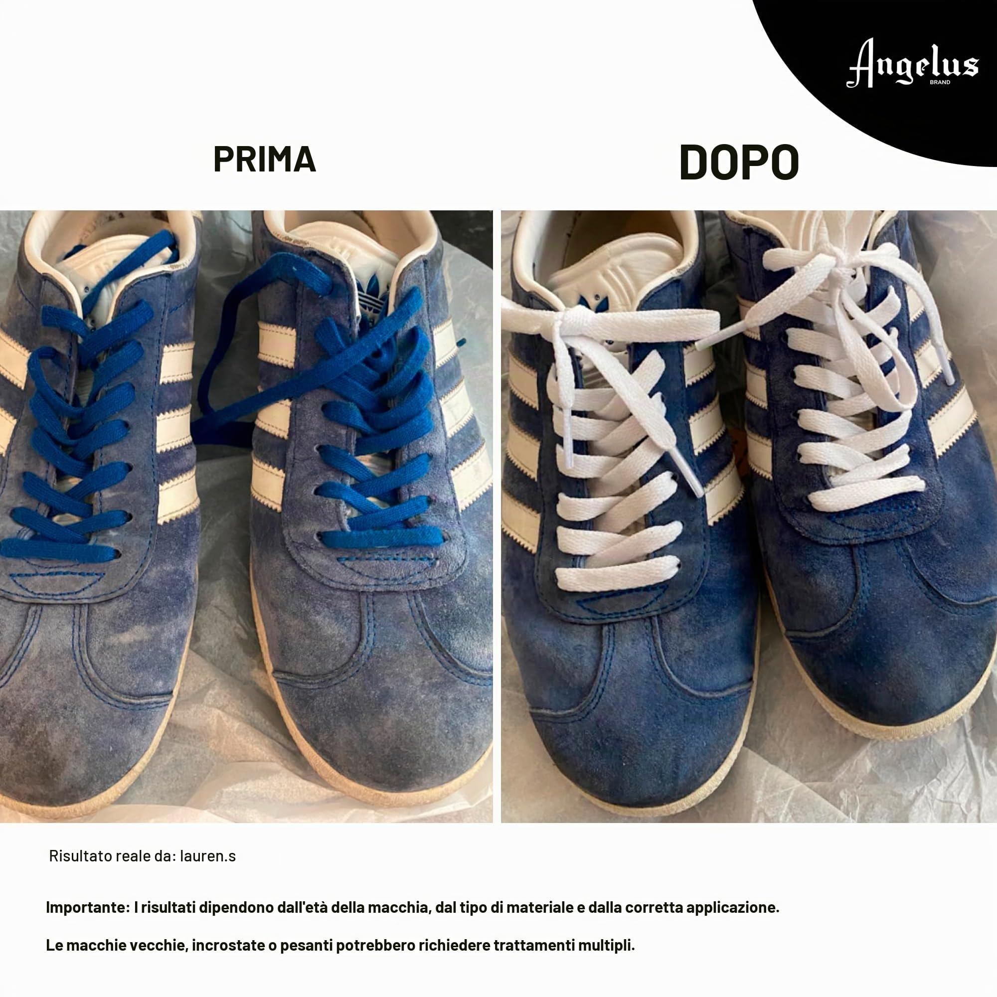 Angelus Suede & Nubuck Cleaner Kit (895-00-000)
