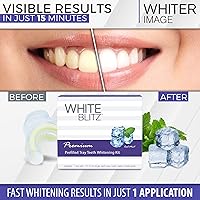 Vista 5 de White Blitz Kit de blanqueamiento de dientes precargado con bandeja sellada al vacío, gel blanqueador de dientes + guía de sombras, menta fría