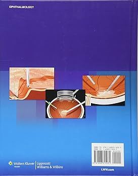 Vitreous Microsurgery: Charles MD, Steve, Calzada MD, Jorge