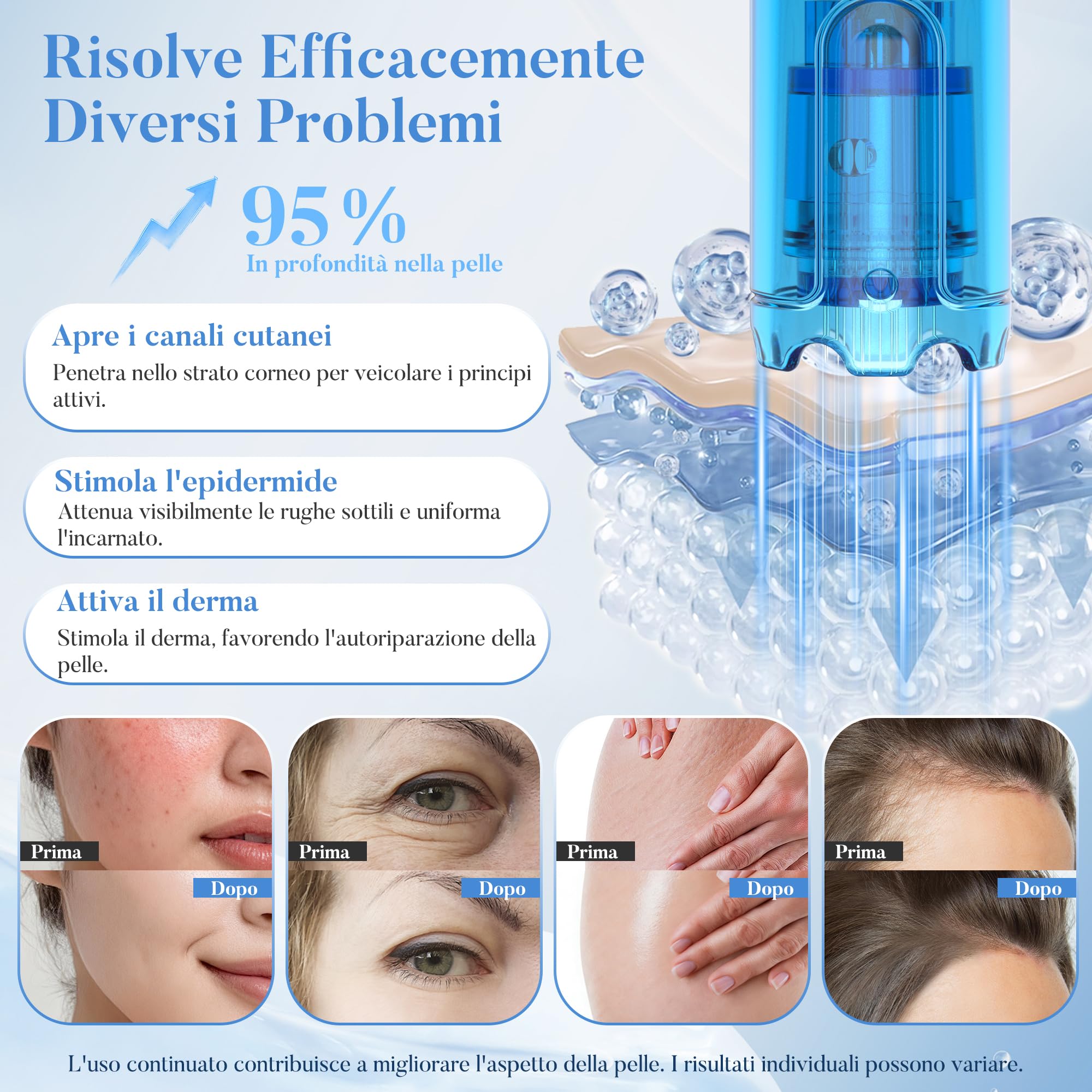 Dr. pen M9 Microneedling Pen, Nuovo Modello 2026 con Regolazione Automatica One-Touch e Chip Intelligente, Base Ricaricabile, 700 mAh, per Rughe, Cicatrici e Barba – 10 Cartucce