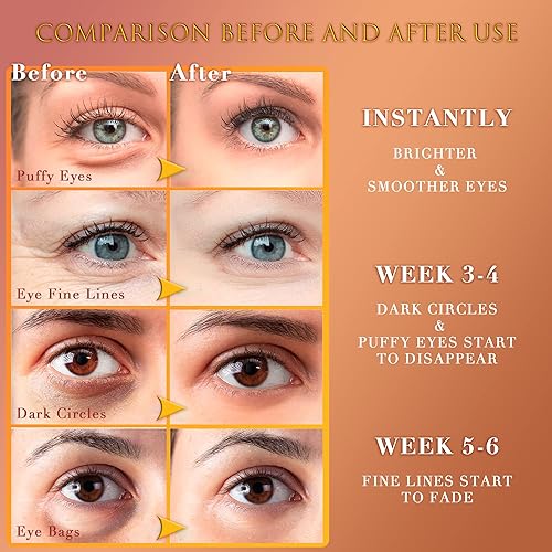 Miniatura 3 de Saimyo Máscara de ojos de oro de 24 quilates, 60 unidades, máscara dorada para debajo de los ojos, retinol y colágeno, tratamientos para ojos