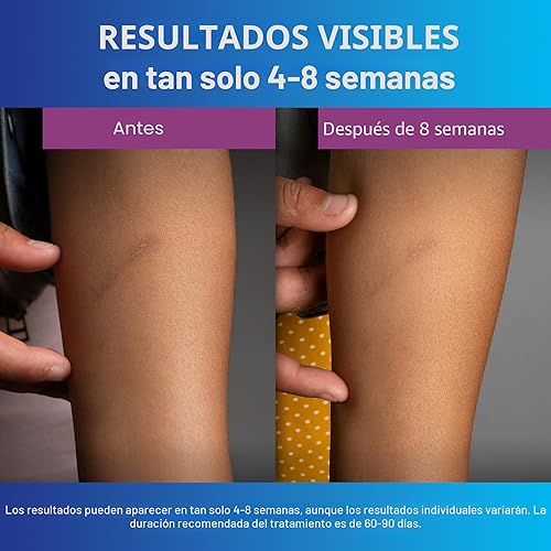 Miniatura 5 de ScarAway Gel de silicona para cicatrices, ayuda a mejorar el tamaño, el color y la textura de las cicatrices hipertróficas y queloides de lesiones