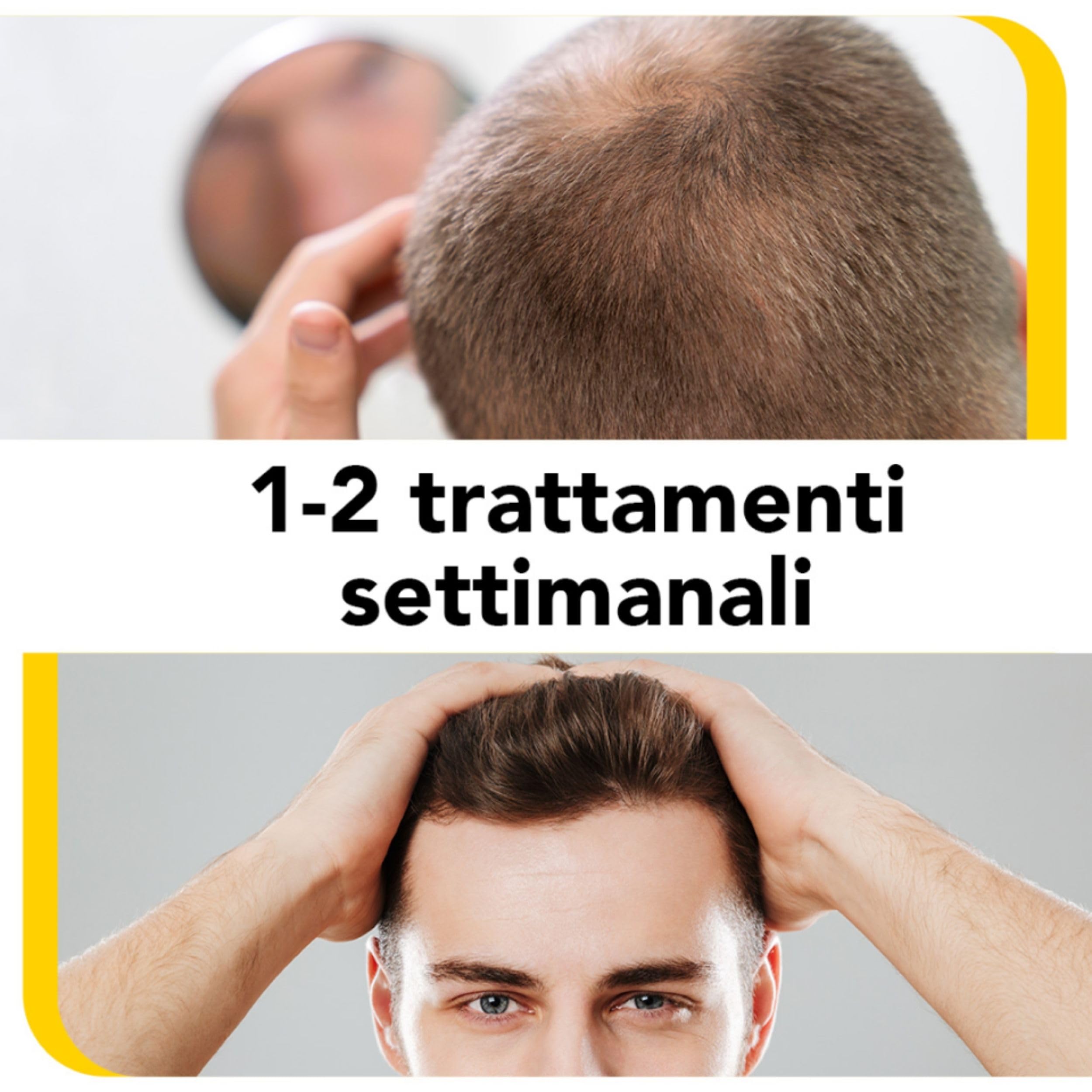 SETA PACK - Fiale Anticaduta Capelli con Biotina 10 pezzi x 10ml - Fiale per Capelli Donna e Uomo - Trattamento Anticaduta