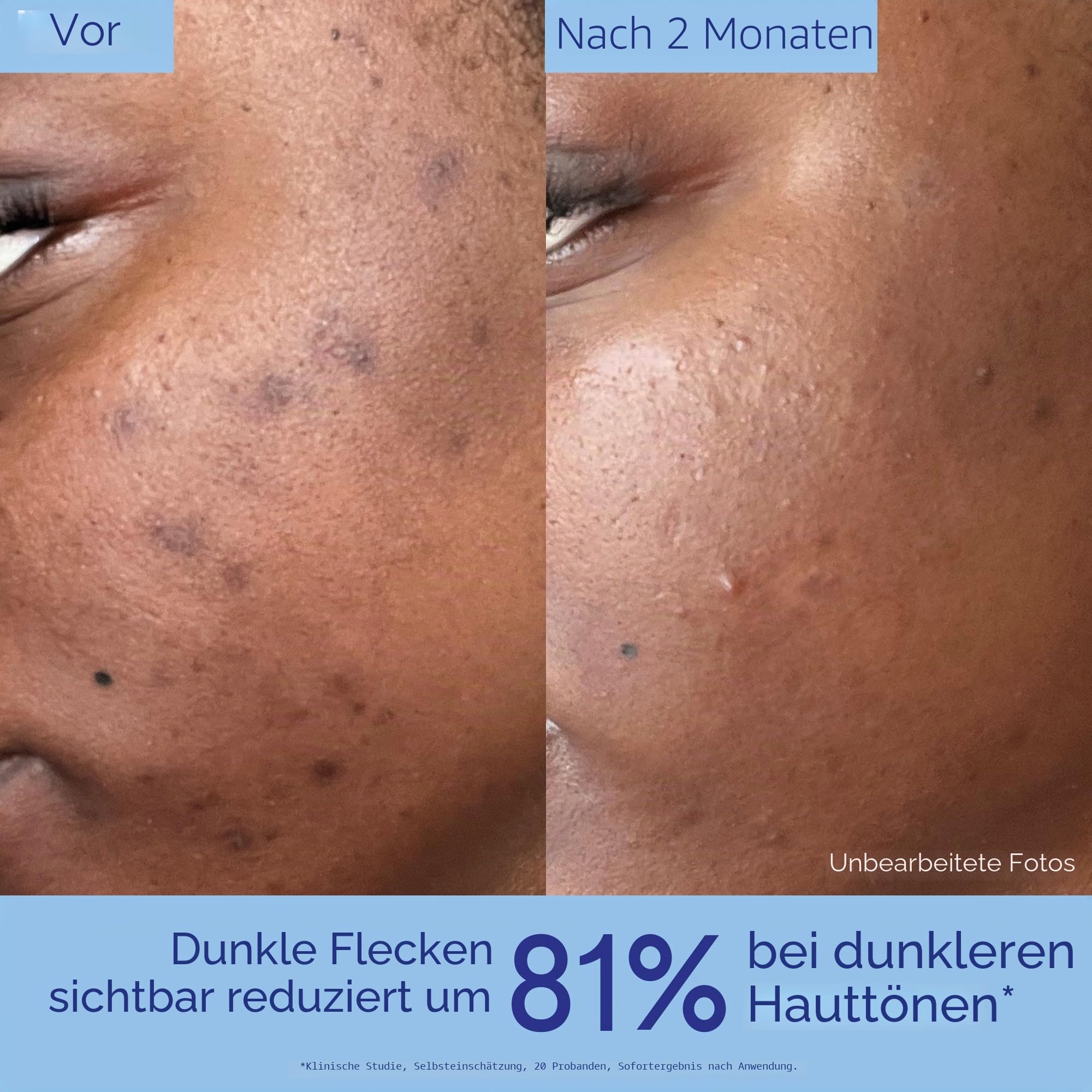 Caudalie Vinoperfect Anti-Pigmentflecken Serum mit Viniferine, 50 ml