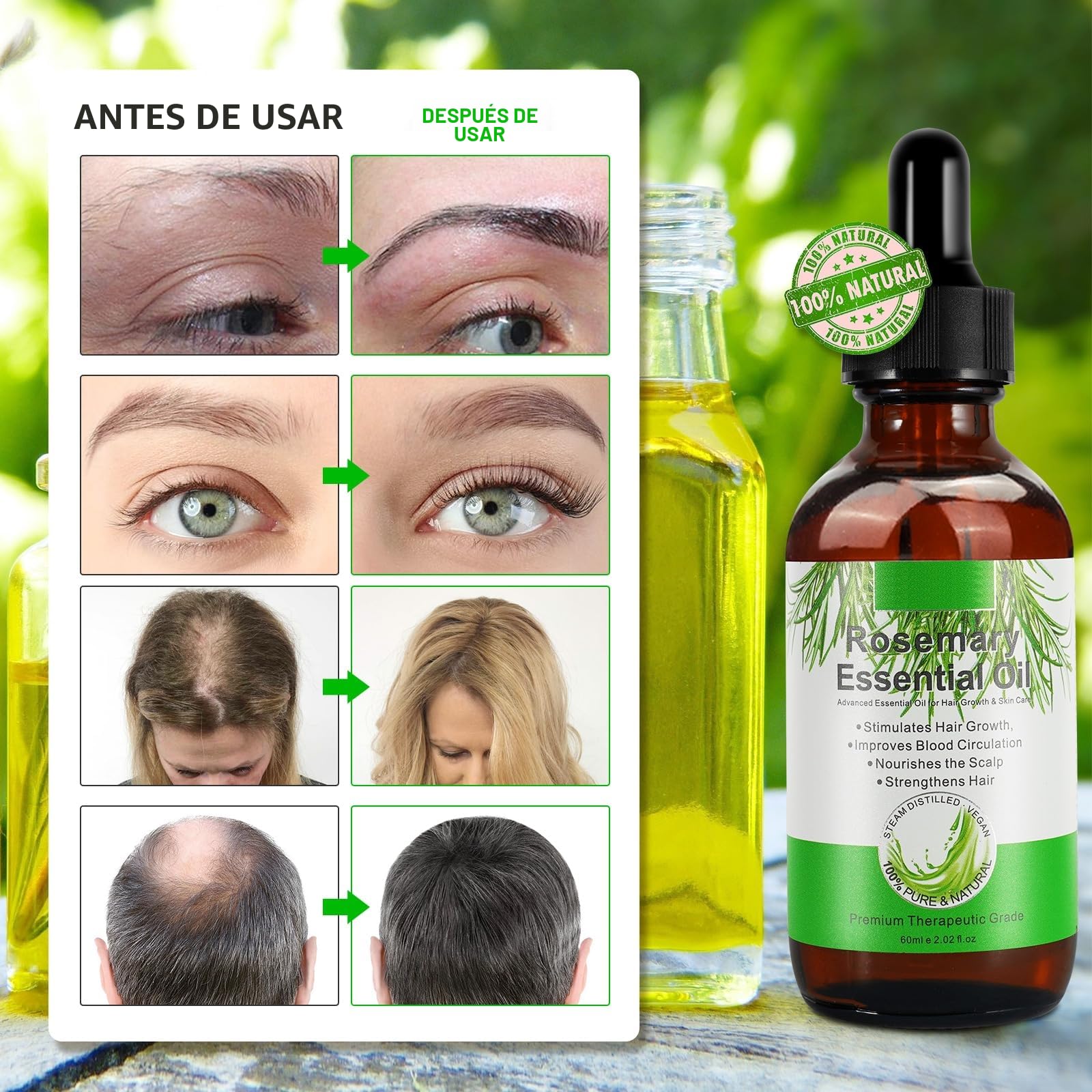 Aceite de Romero 100% puro para Crecimiento del Cabello 60ml con Masajeador de Cuero Cabelludo