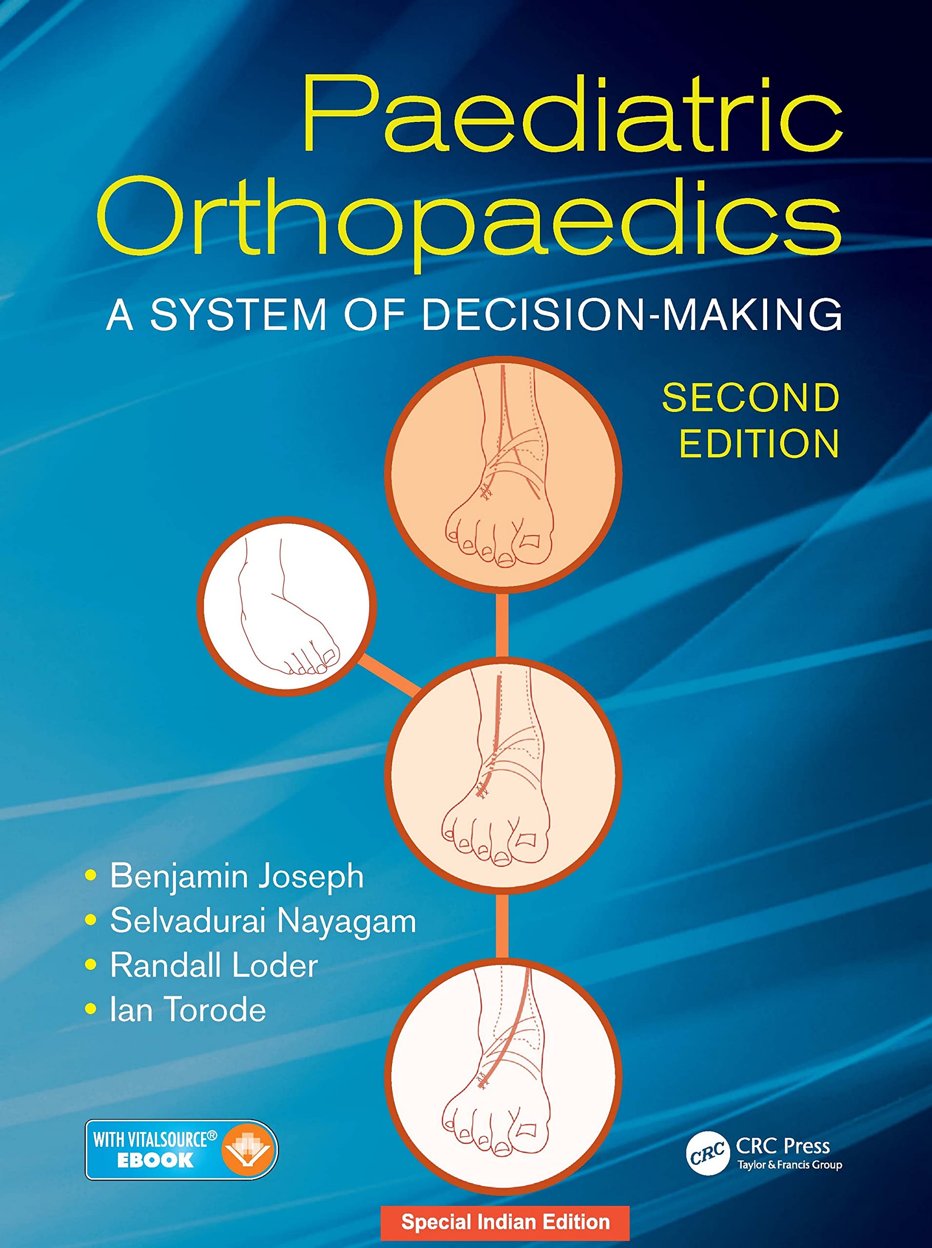 Paediatric Orthopaedics: A System of Decision Making
