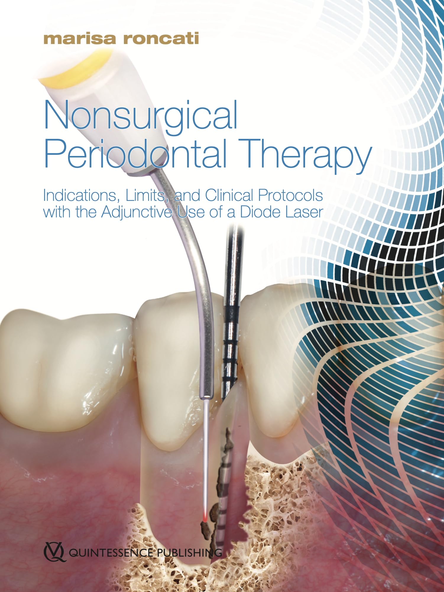 Nonsurgical Periodontal Therapy