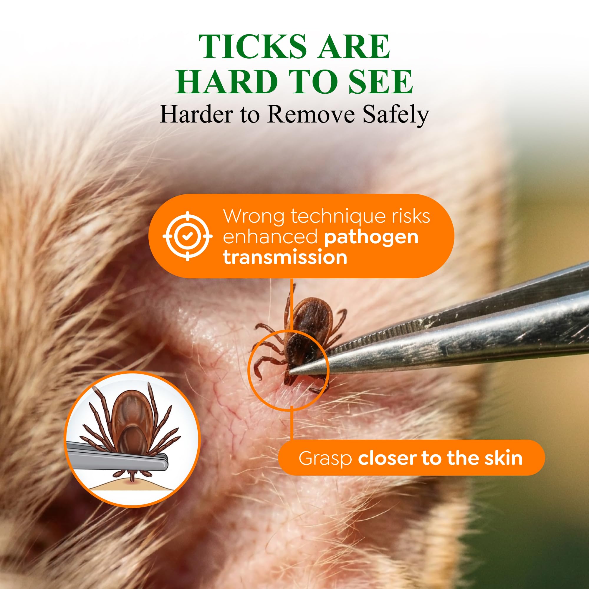 TickBYTES - Kit per la rimozione delle zecche, pinzette a punta fine in acciaio inox con lente d'ingrandimento e carta d'identità, strumento sicuro per rimuovere le zecche, portatile, essenziale per
