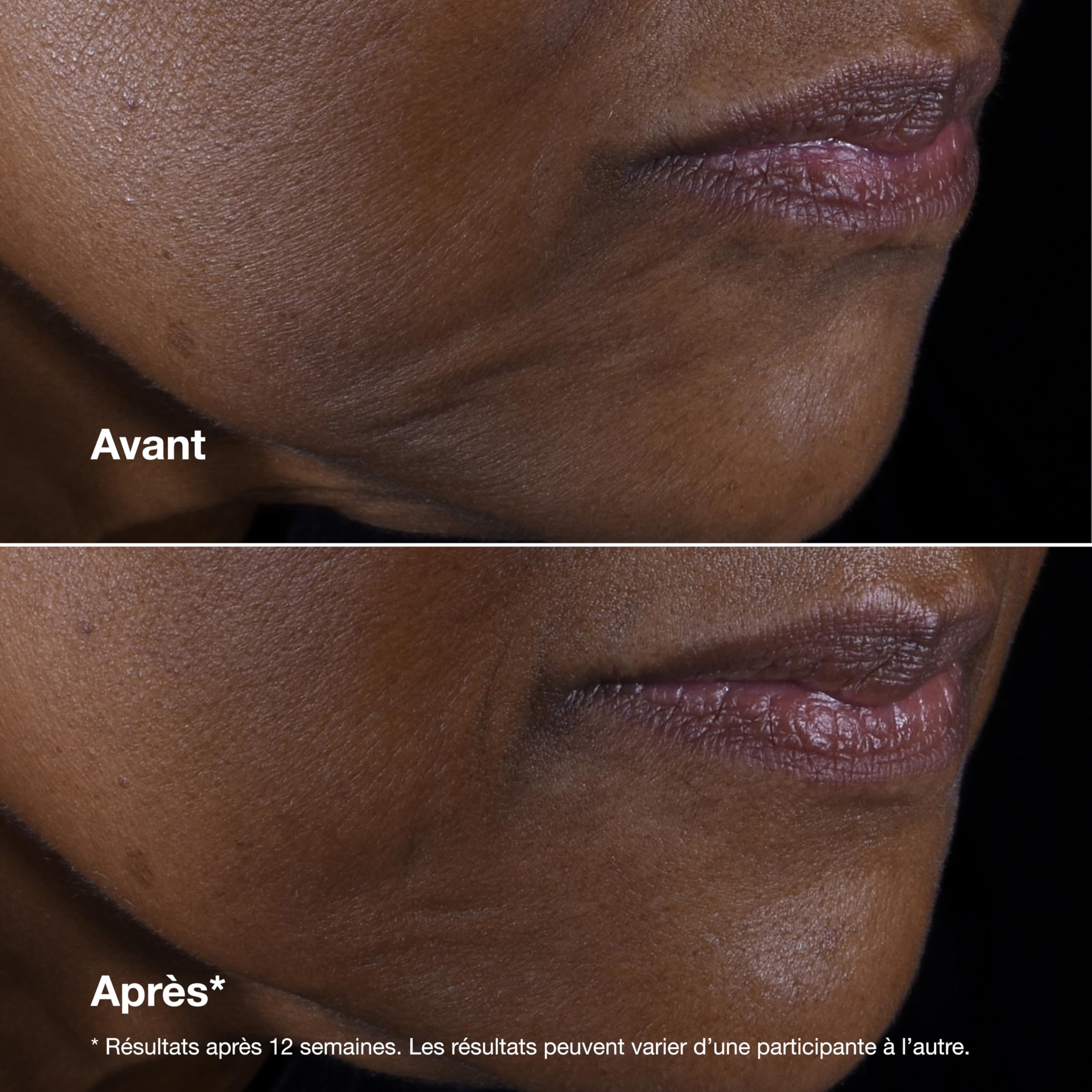 Clinique Smart Clinical Repair Crème Liftante Visage + Cou aux Peptides 9% + Acide Hyaluronique | Anti-Âge + Hydratant