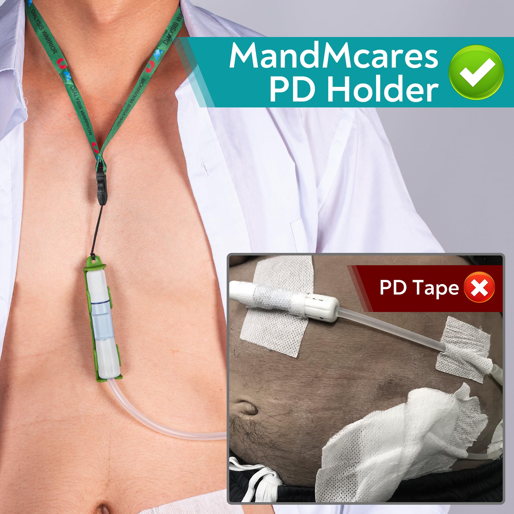 Patented Peritoneal Dialysis Transfer Set Holder for Baxter, PD Catheter Holder Belt