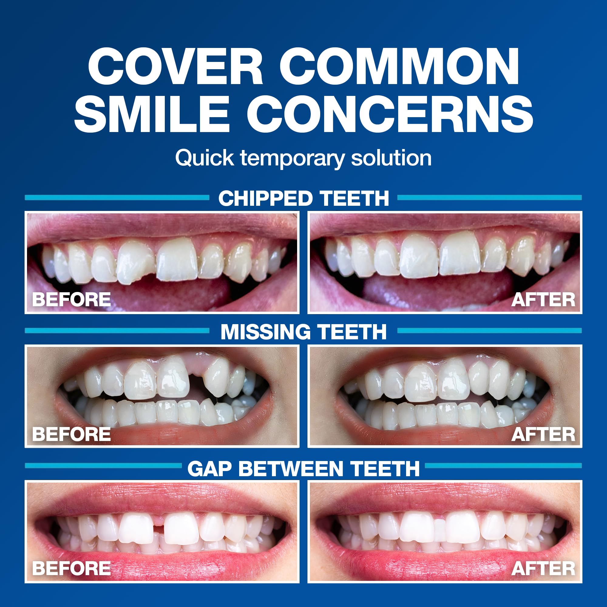 Imako Tooth Tint - Temporary Fake Tooth -7