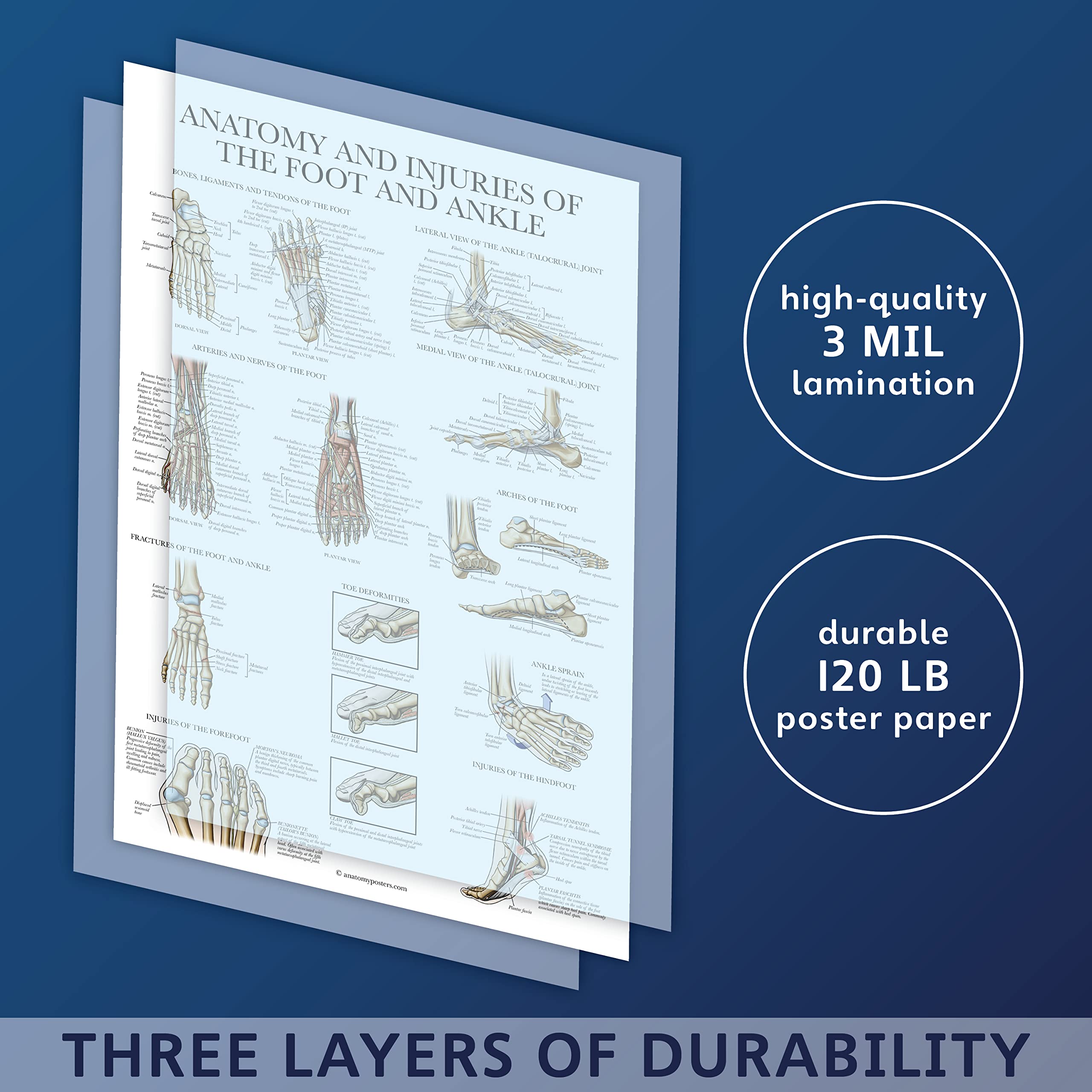 Buy Laminated Anatomy and Injuries of the Foot and Ankle Poster ...