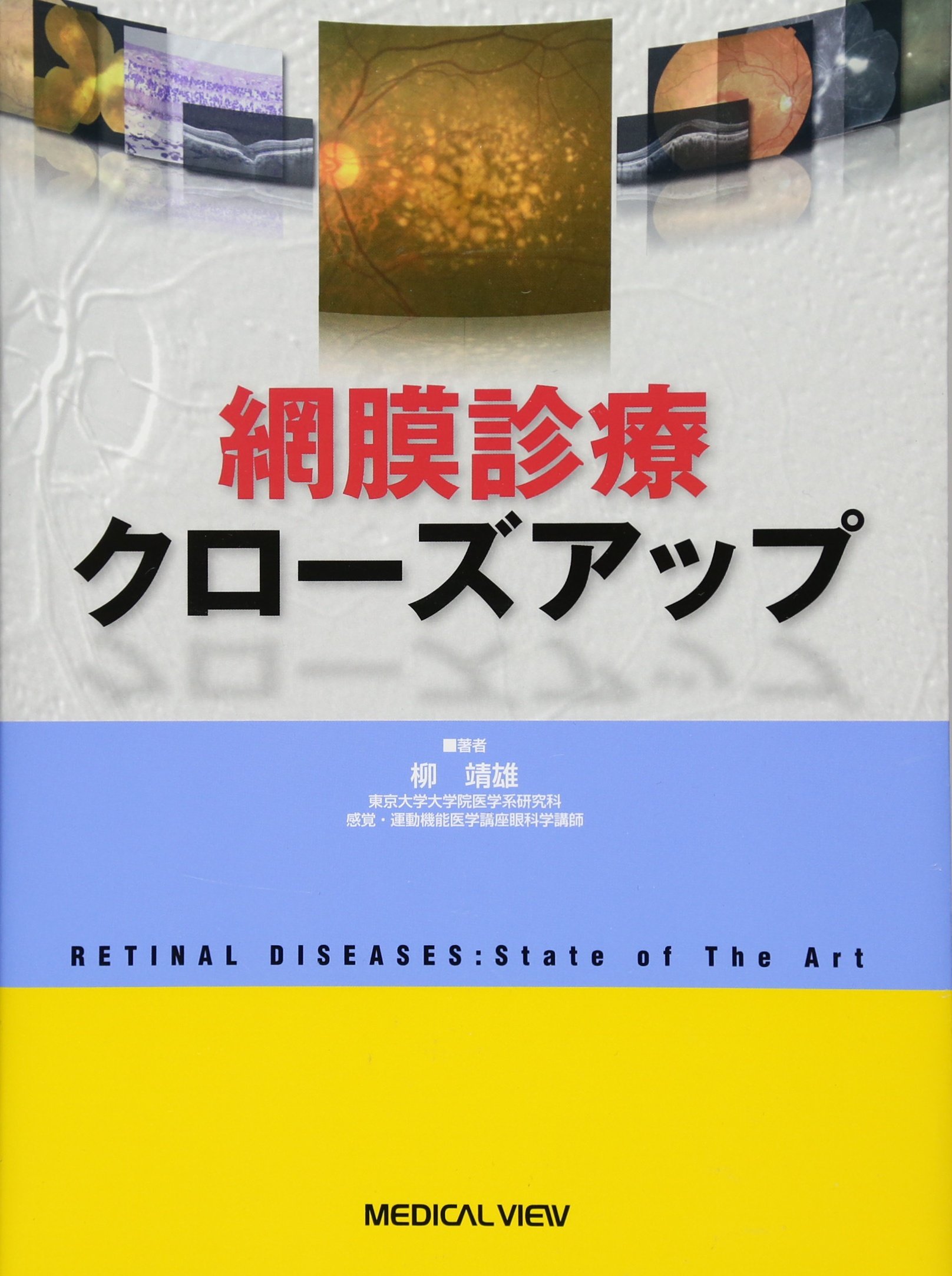 網膜診療クローズアップ　著者 柳　靖雄 812E1MfzuAL.jpg