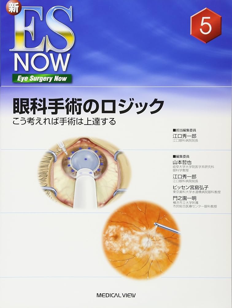 眼科手術のロジック こう考えれば手術は上達する 眼科手術のロジック−こう考えれば手術は上達する (新ES NOW 5