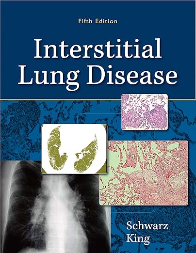E-book - Interstitial Lung Disease Kindle Edition (PDF Instant Download)