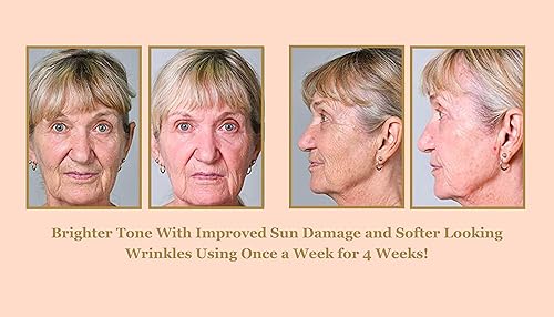 Miniatura 5 de Bee Stunning DIAMONDBUFF - Herramienta de exfoliación microderma para piel brillante y radiante en casa reduce el acné las líneas finas las arrugas