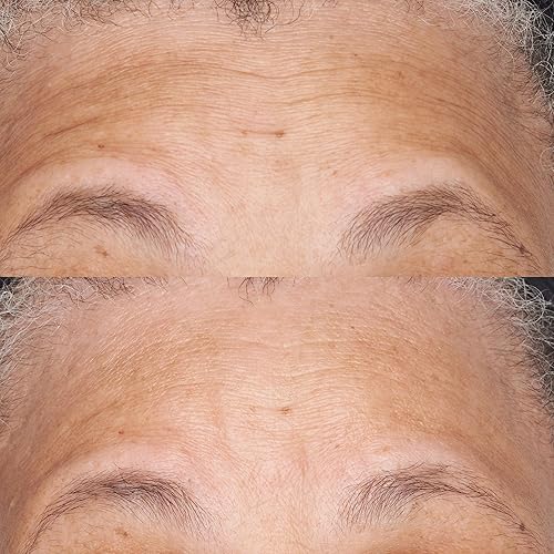 Miniatura 4 de Perricone MD Hidratante nutritivo hipoalergénico de reparación de barreras de corrección limpia, 2 onzas líquidas