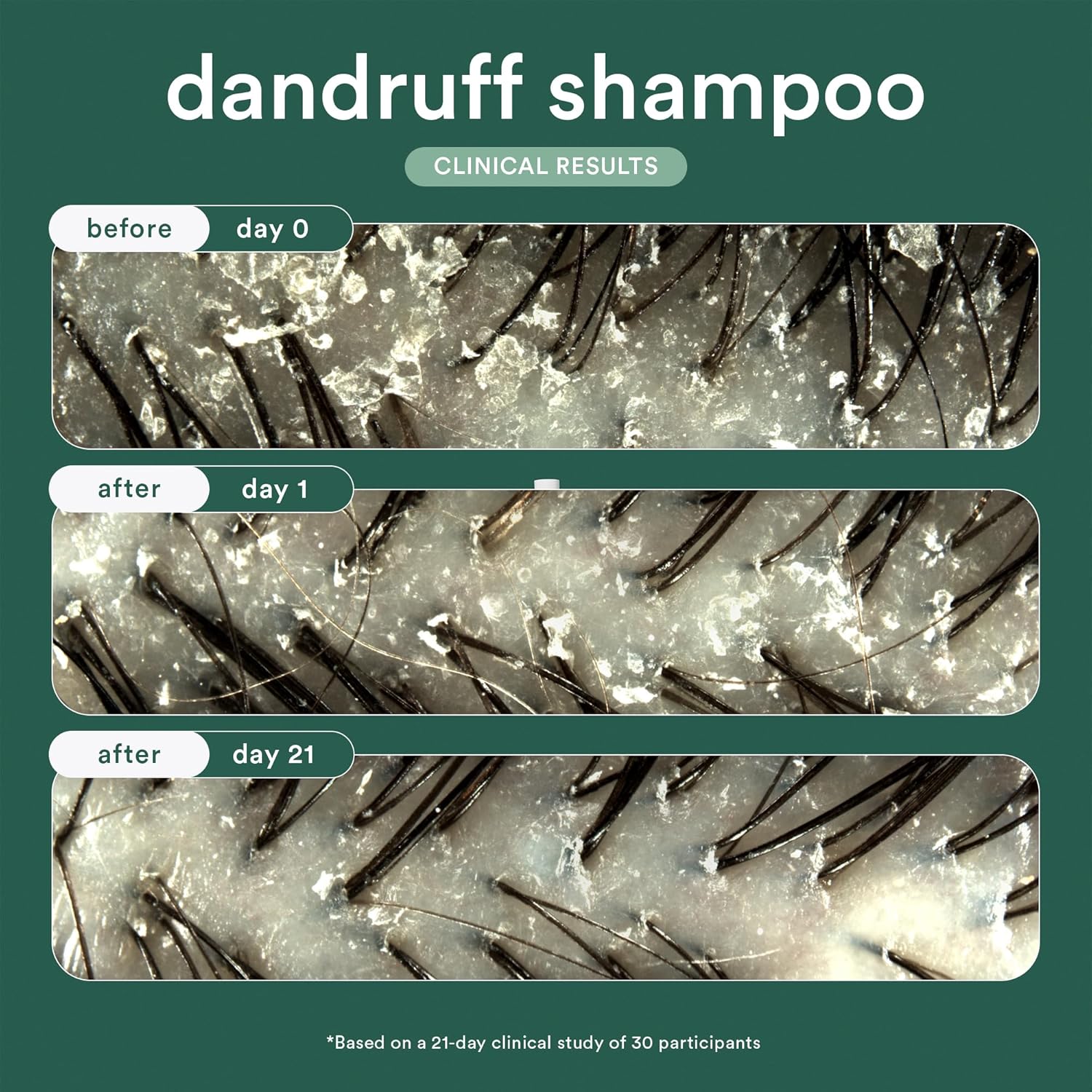 VERB® Dandruff Shampoo - for Gentle Cleansing and Clinical Strength Dandruff Relief with 3% Salicylic Acid - Image 2
