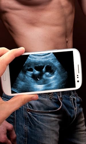 Ultrasound Scanner