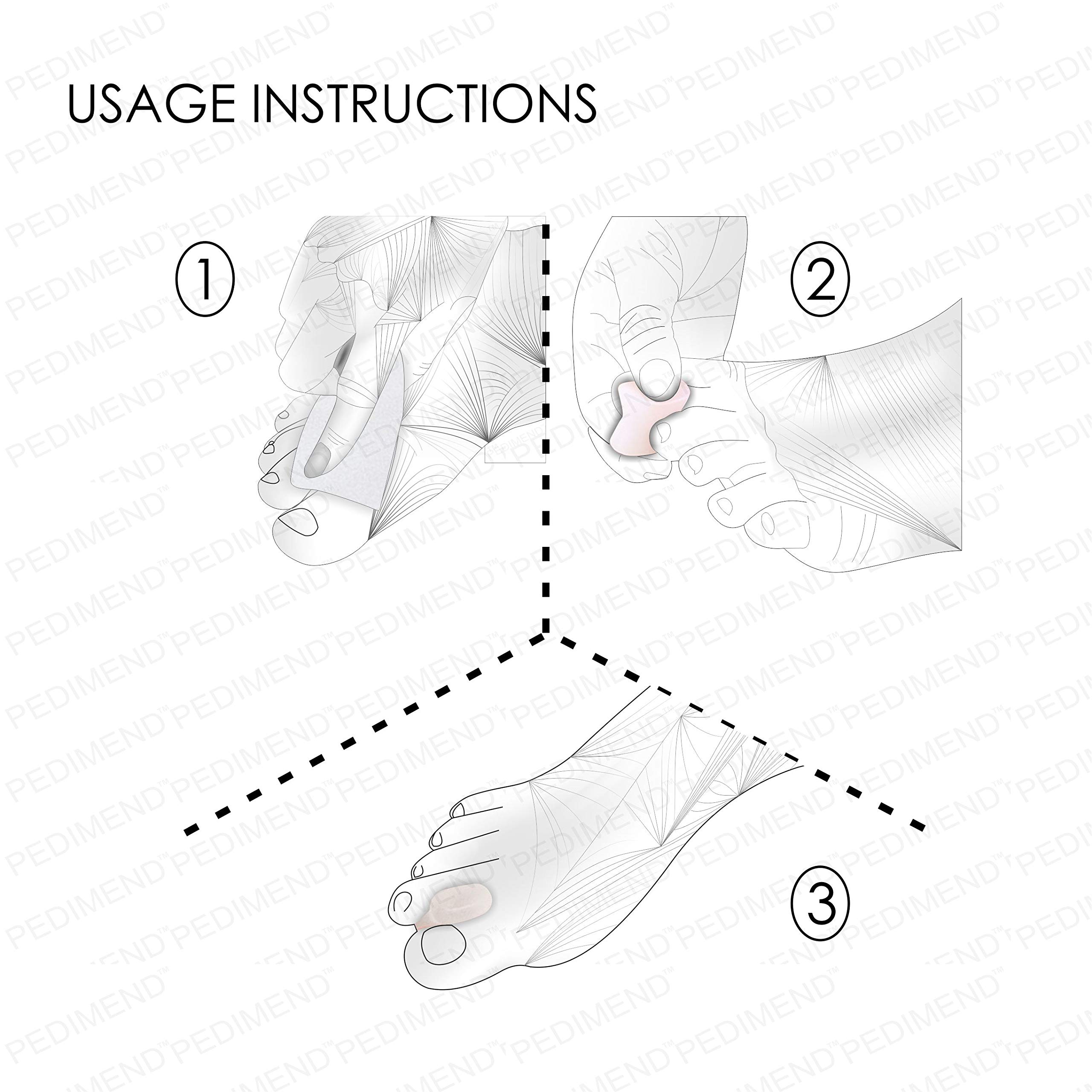Pedimend originale gel Big Toe separatori crocette – (4PAIRS – 8PCS) | alleviare dolori dovuti a calli | alluce valgo sollievo dal dolore per uomini e donne | protegge riallineando & Moisturises |