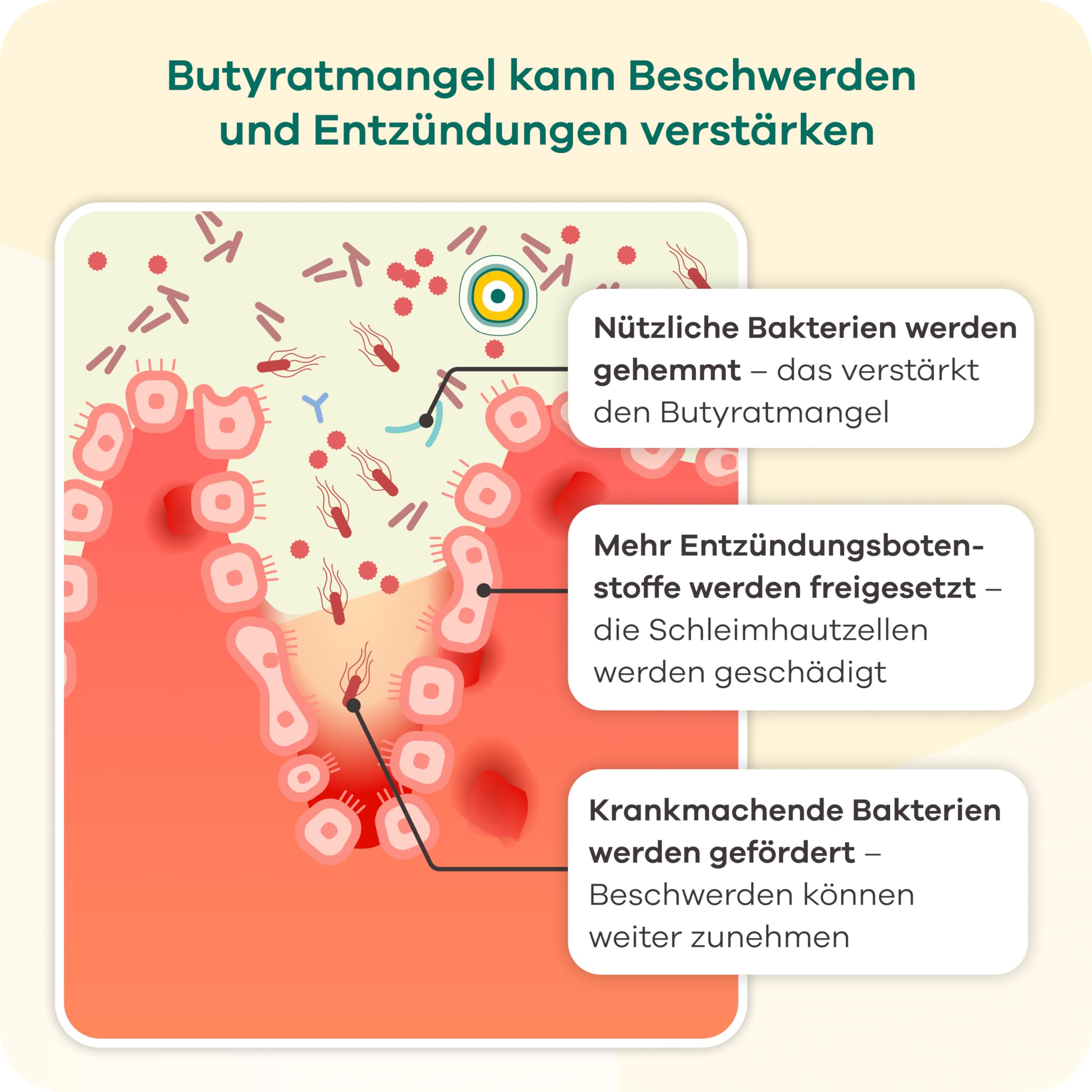 Butyzol Mikroverkapseltes Natriumbutyrat 60 Kapseln – Bei Reizdarmsyndrom, Divertikelkrankheit, Morbus Crohn, Colitis ulcerosa – Patentiert & Wirksamkeit durch Studien belegt