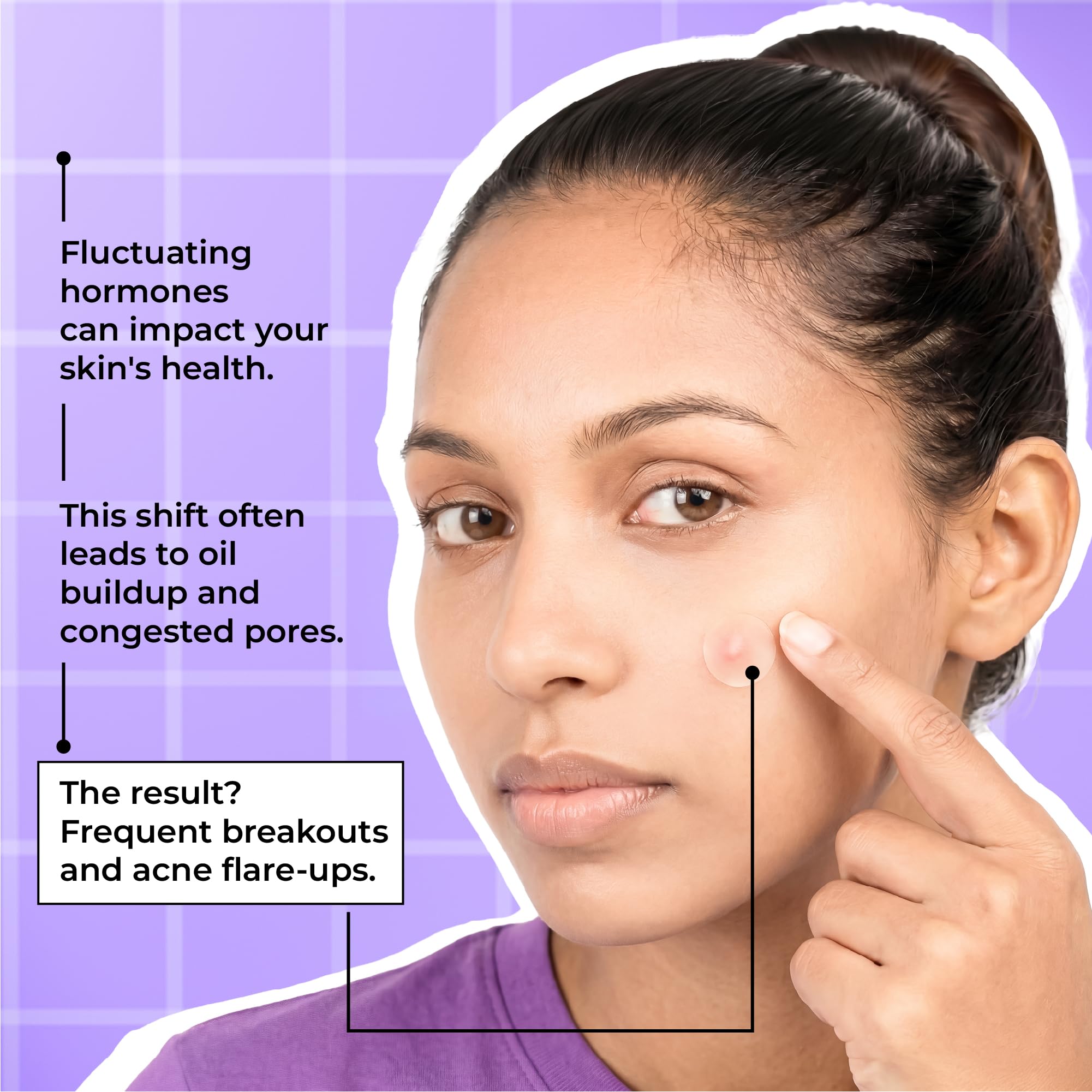 Ultra-Thin Hydrocolloid Pimple Patches β 72 Dots | with 2% Salicylic Acid, Tea Tree & Hyaluronic Acid | Waterproof Acne Spot Cover | Absorbs Pimple Overnight & Reduces Excess Oil | Suitable for All Skin Types 4