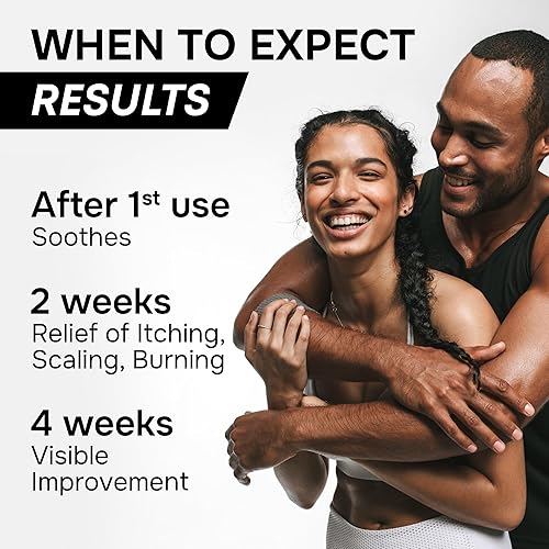 Miniatura 3 de Crema antifúngica para pie de atleta, tiña y picor fornal  Clotrimazol 1% fabricado en Estados Unidos  Gusano anular extra fuerte, crema de picazón