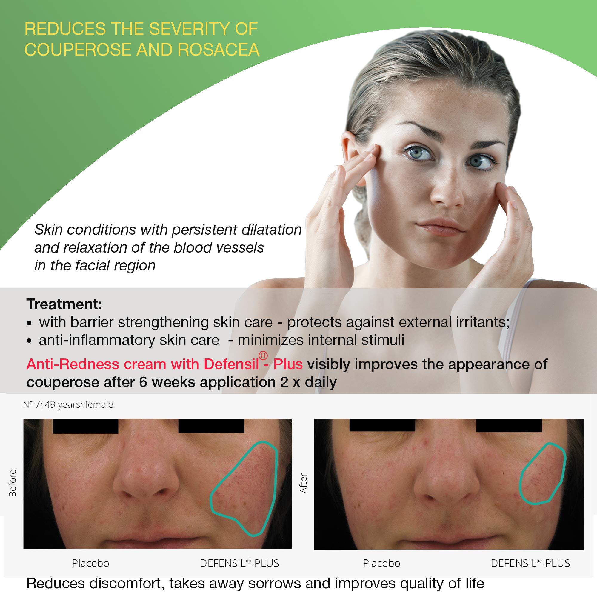 Redness Relief Face Eczema Cream AllNatural Anti Itch Cream Fast