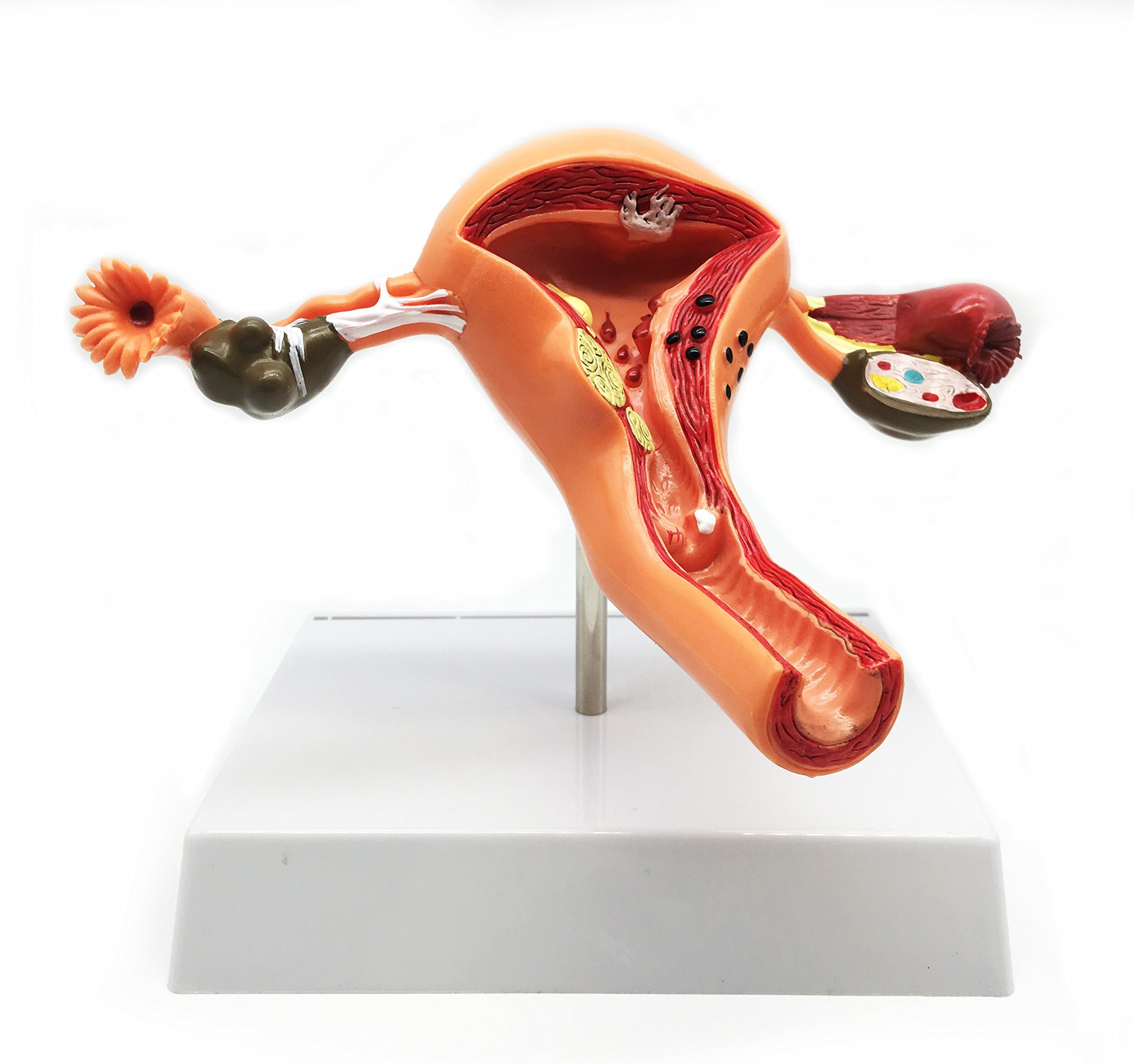 Human Uterus Pathological Model Life-Size Anatomy for Science Classroom Study Display Teaching Medical Model