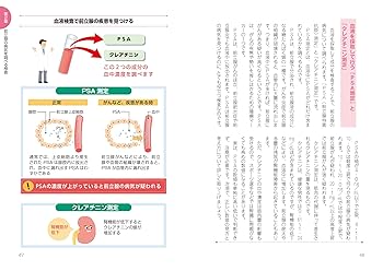 Amazon.co.jp: ウルトラ図解 前立腺の病気 : 高橋 悟: 本
