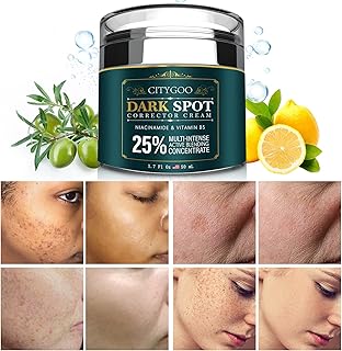 Dark Spot Remover for Face, Dark Spot Corrector Cream, Hyperpigmentation, Melasma, Freckle, Sun Spots Removal for All Skin Types, Dark Spot Corrector for Men and Women-1.7 fl oz