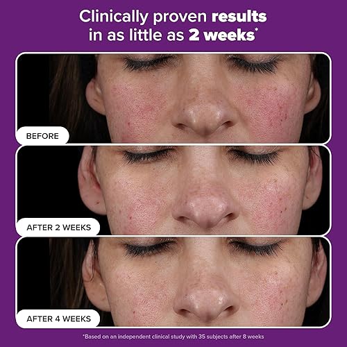 Miniatura 4 de Paula's Choice Suero Facial Pro Retinaldehyde Dual-Retinoide Tratamiento Avanzado, Suero Antienvejecimiento de Alta Potencia para el Rostro, Piel