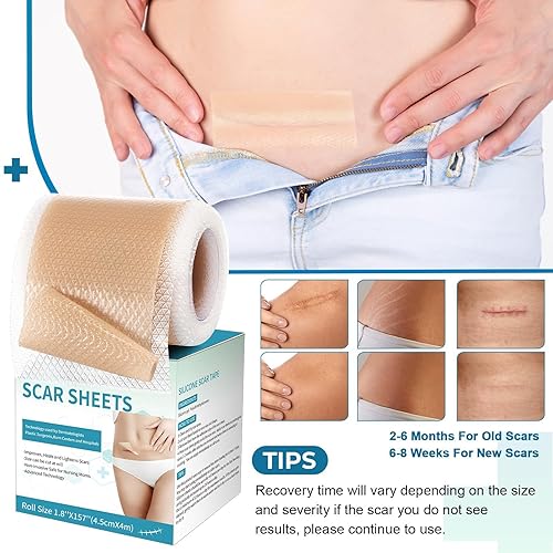Miniatura 5 de Hojas de silicona para cicatrices, cinta de silicona para cicatrices (rollo de 1.8 x 157 pulgadas, 13.1 ft), tiras de cicatrices de silicona, hojas